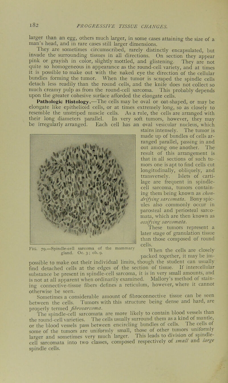 I 82 larger than an egg, others much larger, in some cases attaining the size of a man’s head, and in rare cases still larger dimensions. They are sometimes circumscribed, rarely distinctly encapsulated, but invade the surrounding tissues in all directions. On section they appear pink or grayish in color, slightly mottled, and glistening. They are not quite so homogeneous in appearance as the round-cell variety, and at times it is possible to make out with the naked eye the direction of the cellular bundles forming the tumor. When the tumor is scraped the spindle cells detach less readily than the round cells, and the knife does not collect so much creamy pulp as from the round-cell sarcoma. This probably depends upon the greater cohesive surface afforded the elongate cells. Pathologic Histology.—The cells may be oval or oat-shaped, or may be elongate like epithelioid cells, or at times extremely long, so as closely to resemble the unstriped muscle cells. As a rule, the cells are arranged with their long diameters parallel. In very soft tumors, however, they may be irregularly arranged. Each cell has an oval vesicular nucleus, which stains intensely. The tumor is made up of bundles of cells ar- ranged parallel, passing in and out among one another. The result of this arrangement is that in all sections of such tu- mors one is apt to find cells cut longitudinally, obliquely, and transversely. Islets of carti- lage are frequent in spindle- cell sarcoma, tumors contain- ing them being known as chon- drifying sarcomata. Bony spic- ules also commonly occur in parosteal and periosteal sarco- mata, which are then known as ossifying sarcomata. These tumors represent a later stage of granulation tissue than those composed of round cells. FIG. 79- Spindle-cell sarcoma of the mammary When the cells are closely gland. Oc. 3; ob. 9. . . . . J packed together, it may be 1m- possible to make out their individual limits, though the student can usually find detached cells at the edges of the section of tissue. If intercellular substance be present in spindle-cell sarcoma, it is in very small amounts, and is not at all apparent when ordinarily examined. Mallory’s method of stain- ing connective-tissue fibers defines a reticulum, however, where it cannot otherwise be seen. Sometimes a considerable amount of fibroconnective tissue can be seen between the cells. Tumors with this structure being dense and hard, are properly termed fibrosarcoma. The spindle-cell sarcomata are more likely to contain blood vessels than the round-cell varieties. The cells usually surround them as a kind of mantle, or the blood vessels pass between encircling bundles of cells. 1 he cells of some of the tumors are uniformly small, those of other tumors uniformly larger and sometimes very much larger. I his leads to division ol spine e cell sarcomata into two classes, composed respectively of small and large spindle cells.