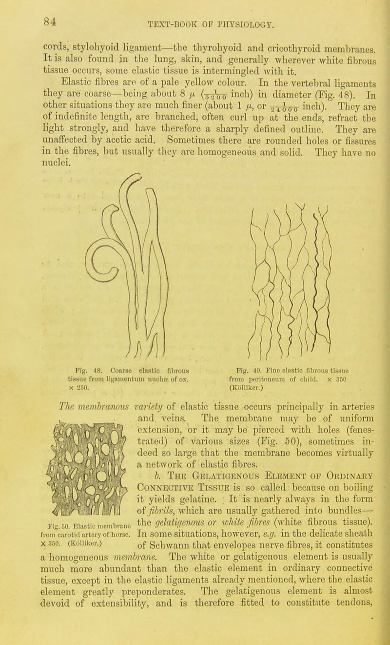 cords, stylohyoid ligament—the thyrohyoid and cricothyroid membranes. It is also found in the lung, skin, and generally wherever white fibrous tissue occurs, some elastic tissue is intermingled with it. Elastic fibres are of a pale yellow colour. In the vertebral ligaments they are coarse—beiiig about 8 (-joVs- inch) in diameter (Fig. 48). In other situations they are much finer (about 1 /x, or in-D-Trcr inch). They are of indefinite length, are branched, often curl up at the ends, refract the light strongly, and have therefore a sharply defined outline. They are unaffected by acetic acid. Sometimes there are rounded holes or fissures in the fibres, but usually they are homogeneous and solid. They have no nuclei. Fig. 48. Coarse elastic fibrous tissue from liKmucntiim nuclia; of ox. X 250. Fig. 49. Fine elastic fibrous tissue from peritoneum of cliilil. x 350 (Kolliker.) The membranous variety of elastic tissue occurs principally in arteries and. veins. The membrane may be of uniform extension, or it may be piei-ced Avith holes (fenes- trated) of various sizes (Fig. 60), sometimes in- deed so large that the membrane becomes virtually a network of elastic fibres. h. The GtElatigenous Element of Ordinaky Connective Tissue is so called because on boiling it yields gelatine. ; It' is nearly always in the form o{ fibrils, which are usually gathered into bundles— the gelatigmous or white fibres (white fibrous tissue). In some situations, however, e.g. in the delicate sheath of SchAvann that envelopes nerve fibi'es, it constitutes a homogeneous membrane. The white or gelatigenous element is usually much more abundant than the elastic element in ordinary connective tissue, except in the elastic ligaments already mentioned, where the elastic element greatly preponderates. The gelatigenous element is almost devoid of extensibility, and is therefore fitted to constitute tendons, 4/\il:t>-:J Fig. 50. Elastic membrane from carotid artery of liorse. X 850. (Kollilier.)