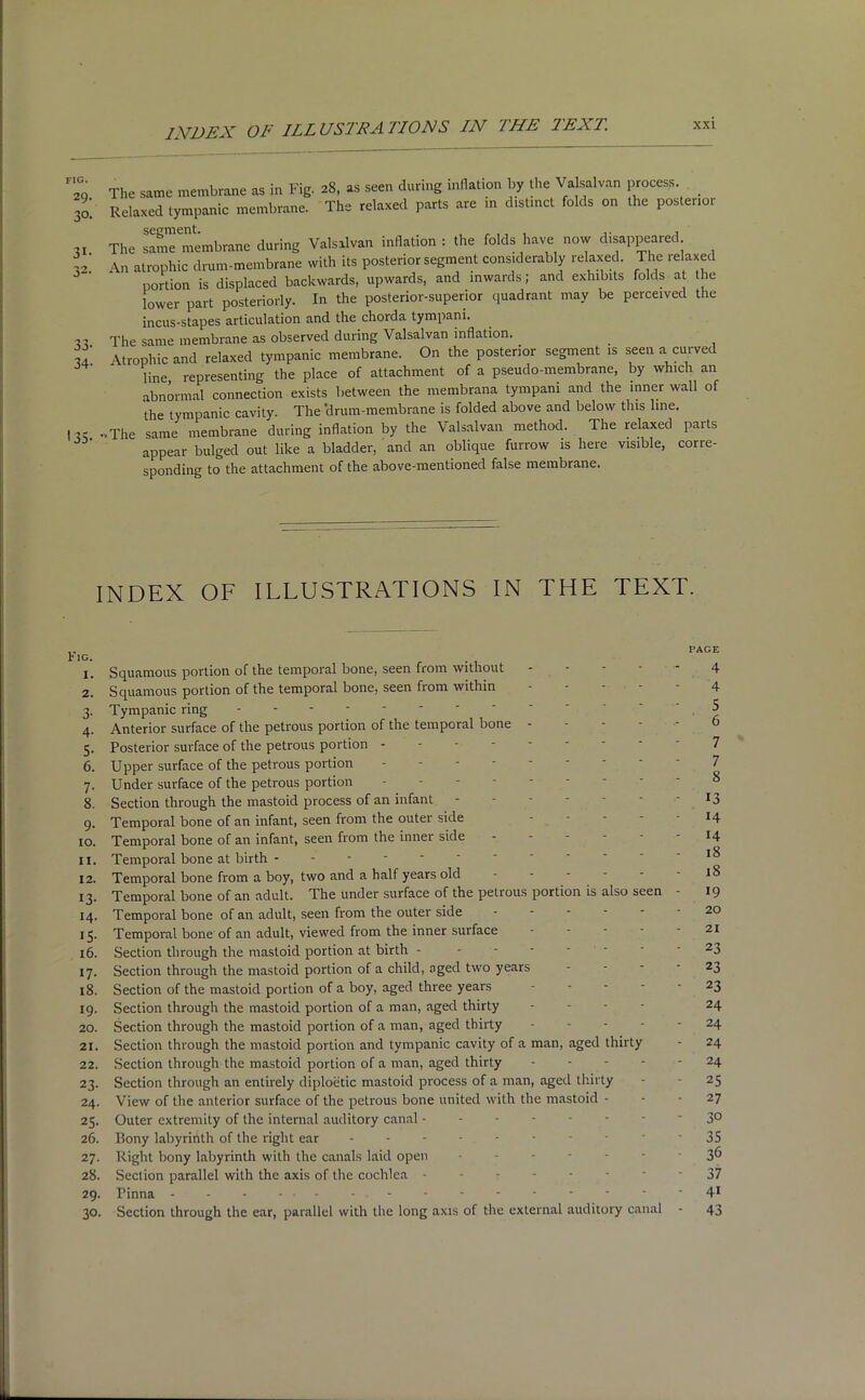 INDEX OF ILLUSTRATIONS IN THE TEXT. FIG. 29. 3°- 3i- 33- 34- * 35- The same membrane as in Fig. 28, as seen during inflation by the Valsalvan process _ Relaxed tympanic membrane. The relaxed parts are m distinct folds on the posterior The same 'membrane during Valsalvan inflation : the folds have now disappeared An atrophic drum-membrane with its posterior segment considerably relaxed. The relaxed portion is displaced backwards, upwards, and inwards; and exhibits folds at the lower part posteriorly. In the posterior-superior quadrant may be perceived the incus-stapes articulation and the chorda tympani. The same membrane as observed during Valsalvan inflation. Atrophic and relaxed tympanic membrane. On the posterior segment is seen a curved line representing the place of attachment of a pseudo-membrane, by which an abnormal connection exists between the membrana tympani and the inner wall of the tympanic cavity. The 'drum-membrane is folded above and below this line. ■-.The same membrane during inflation by the Valsalvan method. The relaxed paits appear bulged out like a bladder, and an oblique furrow is here visible, corre- sponding to the attachment of the above-mentioned false membrane. INDEX OF ILLUSTRATIONS IN THE TEXT. PAGE G. 1. Squamous portion of the temporal bone, seen from without - - - - - 4 2. Squamous portion of the temporal bone, seen from within 4 3. Tympanic ring 4. Anterior surface of the petrous portion of the temporal bone 5. Posterior surface of the petrous portion 7 6. Upper surface of the petrous portion --------- 7 7. Under surface of the petrous portion 8. Section through the mastoid process of an infant *3 9. Temporal bone of an infant, seen from the outer side - - - - *14 10. Temporal bone of an infant, seen from the inner side . - - - - - 14 11. Temporal bone at birth ^ 12. Temporal bone from a boy, two and a half years old ------ 18 13. Temporal bone of an adult. The under surface of the petrous portion is also seen - 19 14. Temporal bone of an adult, seen from the outer side ------ 20 15. Temporal bone of an adult, viewed from the inner surface - - - - - 21 16. Section through the mastoid portion at birth - - - - ' * 23 17. Section through the mastoid portion of a child, aged two years 23 18. Section of the mastoid portion of a boy, aged three years ----- 23 19. Section through the mastoid portion of a man, aged thirty - - - - 24 20. Section through the mastoid portion of a man, aged thirty 24 21. Section through the mastoid portion and tympanic cavity of a man, aged thirty - 24 22. Section through the mastoid portion of a man, aged thirty ----- 24 23. Section through an entirely diploetic mastoid process of a man, aged thirty - - 25 24. View of the anterior surface of the petrous bone united with the mastoid - - - 27 25. Outer extremity of the internal auditory canal -------- 3° 26. Bony labyrinth of the right ear -------- 35 27. Right bony labyrinth with the canals laid open ------- 3^ 28. Section parallel with the axis of the cochlea r ----- 37 29. Pinna - - - ... - - - - - - - - - 41 30. Section through the ear, parallel with the long axis of the external auditory canal - 43