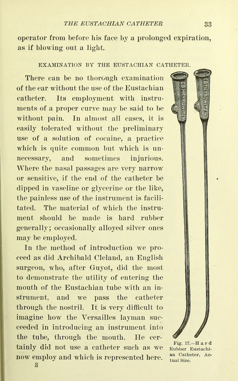 operator from before his face by a prolonged expiration, as if blowing out a light. EXAMINATION BY THE EUSTACHIAN CATHETER. There can be no thorough examination of the ear without the use of the Eustachian catheter. Its employment with instru- ments of a proper curve may be said to be without pain. In almost all cases, it is easily tolerated without the preliminary use of a solution of cocaine, a practice which is quite common but which is un- necessary, and sometimes injurious. Where the nasal passages are very narrow or sensitive, if the end of the catheter be dipped in vaseline or glycerine or the like, the painless use of the instrument is facili- tated. The material of which the instru- ment should be made is hard rubber generally; occasionally alloyed silver ones may be employed. In the method of introduction we pro- ceed as did Archibald Cleland, an English surgeon, who, after Guyot, did the most to demonstrate the utility of entering the mouth of the Eustachian tube with an in- strument, and we pass the catheter through the nostril. It is very difficult to imagine how the Versailles layman suc- ceeded in introducing an instrument into the tube, through the mouth. He cer- tainly did not use a catheter such as we now employ and which is represented here. 3 Fig. 17.—H a r d Rubber Eustachi- an Catheter, Ac- tual Size.