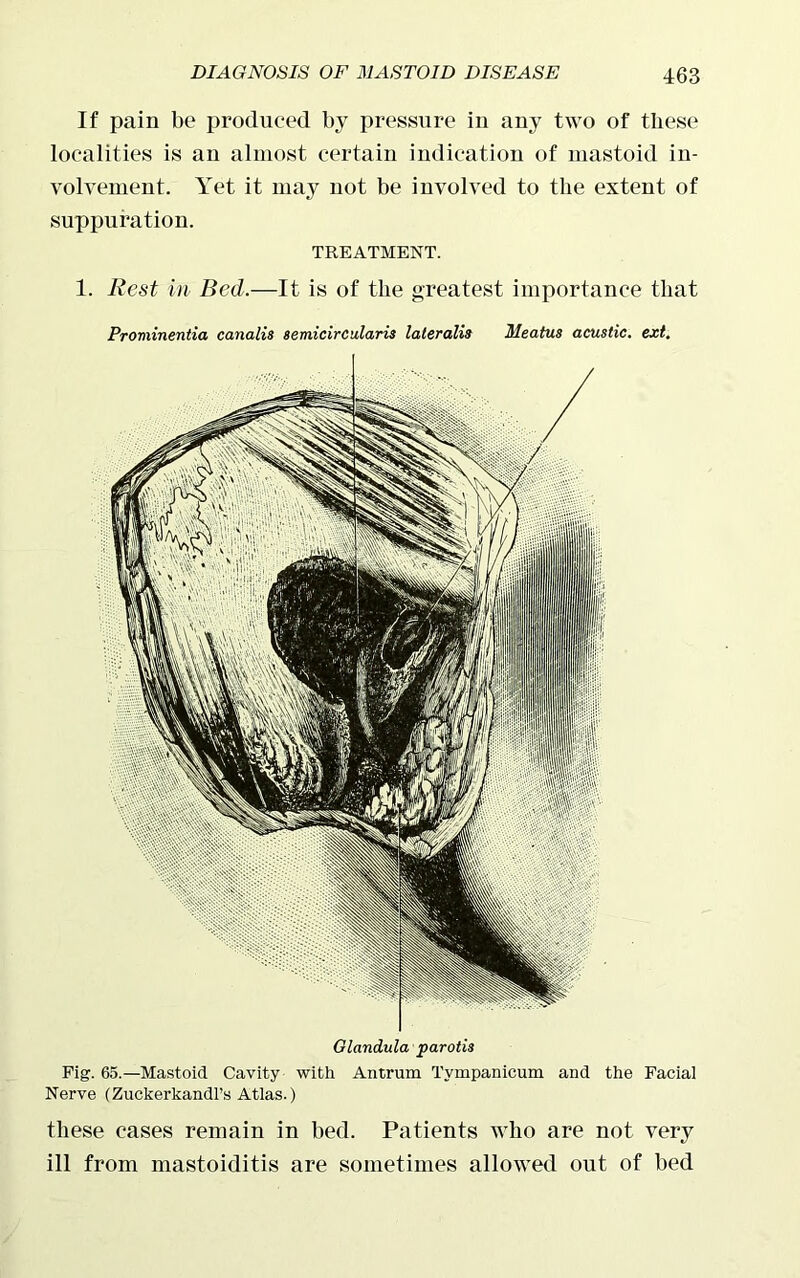If pain be produced by pressure in any two of these localities is an almost certain indication of mastoid in- volvement. Yet it may not be involved to the extent of suppuration. TREATMENT. 1. Rest in Bed.—It is of the greatest importance that Prominentia canalis semicircularis lateralis Meatus acustic. ext. Fig. 65.—Mastoid Cavity with Antrum Tvmpanicum and the Facial Nerve (Zuckerkandl’s Atlas.) these cases remain in bed. Patients who are not very ill from mastoiditis are sometimes allowed out of bed