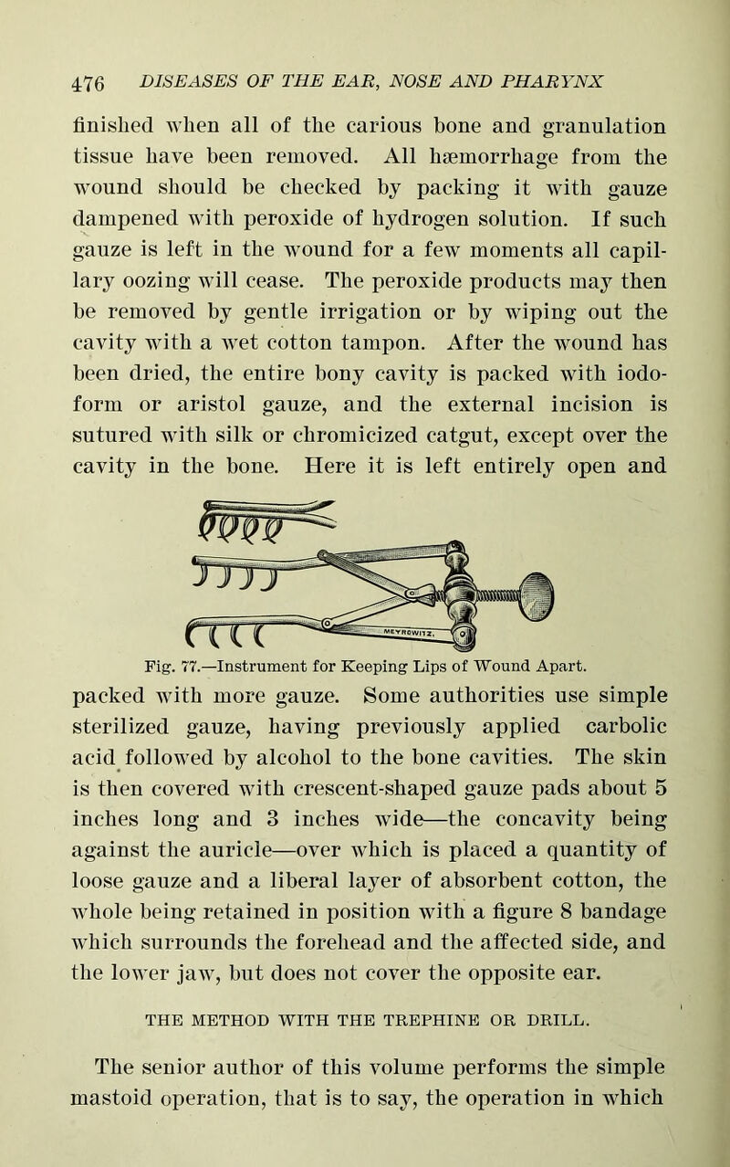 finished when all of the carious bone and granulation tissue have been removed. All haemorrhage from the wound should be checked by packing it with gauze dampened with peroxide of hydrogen solution. If such gauze is left in the wound for a few moments all capil- lary oozing will cease. The peroxide products may then be removed by gentle irrigation or by wiping out the cavity with a wet cotton tampon. After the wound has been dried, the entire bony cavity is packed with iodo- form or aristol gauze, and the external incision is sutured with silk or chromicized catgut, except over the cavity in the bone. Here it is left entirely open and Fig. 77.—Instrument for Keeping Lips of Wound Apart. packed with more gauze. Some authorities use simple sterilized gauze, having previously applied carbolic acid followed by alcohol to the bone cavities. The skin is then covered with crescent-shaped gauze pads about 5 inches long and 3 inches wide—the concavity being against the auricle—over which is placed a quantity of loose gauze and a liberal layer of absorbent cotton, the whole being retained in position with a figure 8 bandage which surrounds the forehead and the affected side, and the lower jaw, but does not cover the opposite ear. THE METHOD WITH THE TREPHINE OR DRILL. The senior author of this volume performs the simple mastoid operation, that is to say, the operation in which