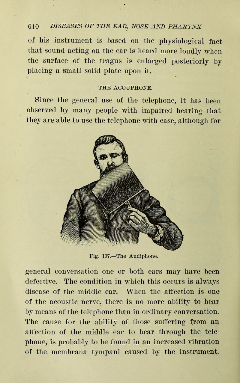of his instrument is based on the physiological fact that sound acting on the ear is heard more loudly when the surface of the tragus is enlarged posteriorly by placing a small solid plate upon it. THE ACOUPHONE. Since the general use of the telephone, it has been observed by many people with impaired hearing that they are able to use the telephone with ease, although for Fig. 107.—The Audiphone. general conversation one or both ears may have been defective. The condition in which this occurs is always disease of the middle ear. When the affection is one of the acoustic nerve, there is no more ability to hear by means of the telephone than in ordinary conversation. The cause for the ability of those suffering from an affection of the middle ear to hear through the tele- phone, is probably to be found in an increased vibration of the membrana tympani caused by the instrument.