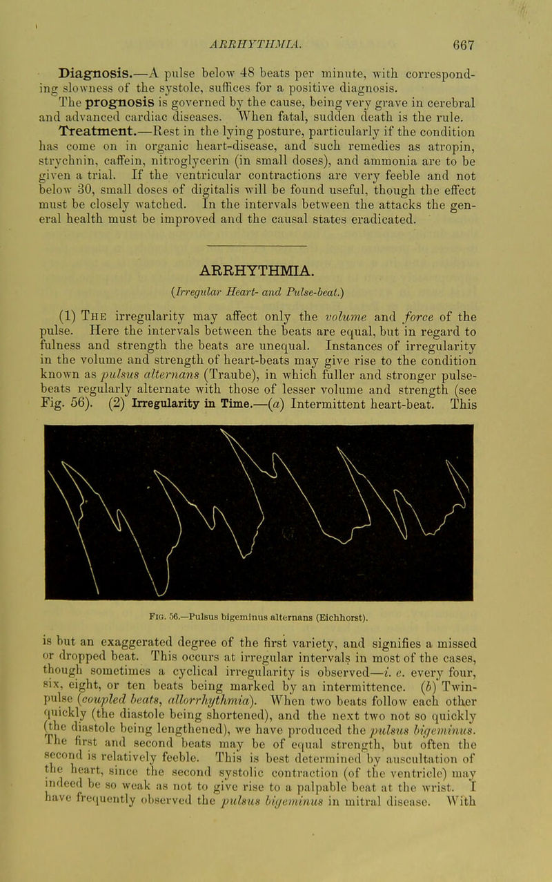 ARRHYTHMIA. 667 Diagnosis.—A pulse below 48 beats per minute, with correspond- ing slowness of the systole, suffices for a positive diagnosis. The prognosis is governed by the cause, being very grave in cerebral and advanced cardiac diseases. When fatal, sudden death is the rule. Treatment.—Rest in the lying posture, particularly if the condition has come on in organic heart-disease, and such remedies as atropin, strychnin, caffein, nitroglycerin (in small doses), and ammonia are to be given a trial. If the ventricular contractions are very feeble and not below 30, small doses of digitalis will be found useful, though the effect must be closely watched. In the intervals between the attacks the gen- eral health must be improved and the causal states eradicated. ARRHYTHMIA. (Irregular Heart- and Pulse-beat.) (1) The irregularity may affect only the volume and force of the pulse. Here the intervals between the beats are equal, but in regard to fulness and strength the beats are unequal. Instances of irregularity in the volume and strength of heart-beats may give rise to the condition known as pulsus alternans (Traube), in which fuller and stronger pulse- beats regularly alternate with those of lesser volume and strength (see Fig. 56). (2) Irregularity in Time.—(a) Intermittent heart-beat. This Fig. 56—Pulsus bigeminus alternans (Eichhorst). is but an exaggerated degree of the first variety, and signifies a missed or dropped beat. This occurs at irregular intervals in most of the cases, though sometimes a cyclical irregularity is observed—i. e. every four, six, eight, or ten beats being marked by an intermittence. (b) Twin- pulse (coupled beats, allorrhythmid). When two beats follow each other quickly (the diastole being shortened), and the next two not so quickly (the diastole being lengthened), we have produced the pulsus bigeminus. he first and second beats may be of equal strength, but often the second is relatively feeble. This is best determined by auscultation of the heart, since the second systolic contraction (of the ventricle) may indeed be so weak as not to give rise to a palpable beat at the wrist. I have frequently observed the pulsus bigeminus in mitral disease. With