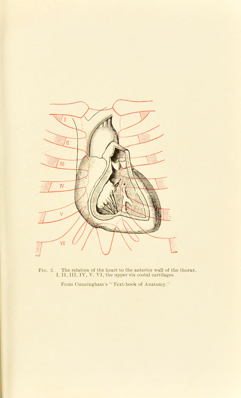 Fici. 2. The relation of the heart to the anterior wall of the thorax. I, II, III, IV, V. VI, the upper six costal cartilages.