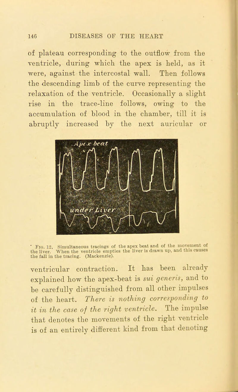 of plateau corresponding to the outflow from the ventricle, during which the apex is held, as it were, against the intercostal wall. Then follows the descending limb of the curve representing the relaxation of the ventricle. Occasionally a slight rise in the trace-line follows, owing to the accumulation of blood in the chamber, till it is abruptly increased by the next auricular or ' Fig. 12, Simultaneous tracings of the apex beat and of the movement of the liver. When the ventricle empties the liver is drawn up, and this causes the fall in the tracing. (Mackenzie). ventricular contraction. It has been already explained how the apex-beat is sui generis, and to be carefully distinguished from all other impulses of the heart. There is nothing corresponding to it in the case of the right ventricle. The impulse that denotes the movements of the right ventricle is of an entirely different kind from that denoting