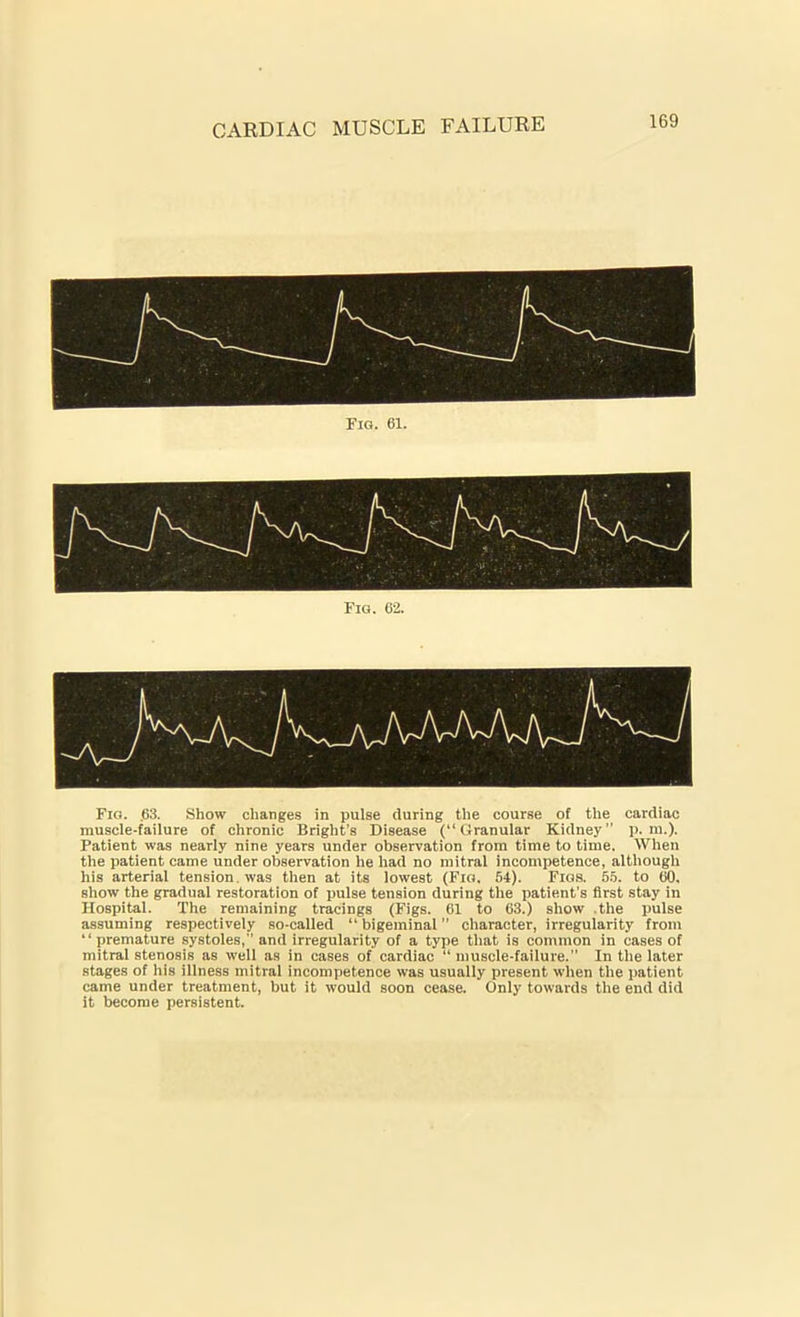 CARDIAC MUSCLE FAILURE Fig. 61. Fig. 62. Fig. .63. Show changes in pulse during the course of the cardiac muscle-failure of chronic Bright’s Disease (“Granular Kidney p. m.). Patient was nearly nine years under observation from time to time. When the patient came under observation he had no mitral incompetence, although his arterial tension, was then at its lowest (Fig. 64). Figs. 55. to 60, show the gradual restoration of pulse tension during the patient’s first stay in Hospital. The remaining tracings (Figs. 61 to 63.) show .the pulse assuming respectively so-called “ bigeminal” character, irregularity from “premature systoles,  and irregularity of a type that is common in cases of mitral stenosis as well as in cases of cardiac “muscle-failure.” In the later stages of his illness mitral incompetence was usually present when the patient came under treatment, but it would soon cease. Only towards the end did it become persistent.