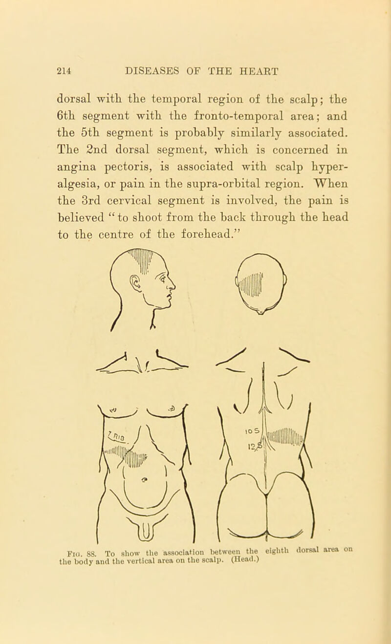 dorsal with the temporal region of the scalp; the 6th segment with the fronto-temporal area; and the 5th segment is probably similarly associated. The 2nd dorsal segment, which is concerned in angina pectoris, is associated with scalp hyper- algesia, or pain in the supra-orbital region. When the 3rd cervical segment is involved, the pain is believed “ to shoot from the hack through the head to the centre of the forehead.”