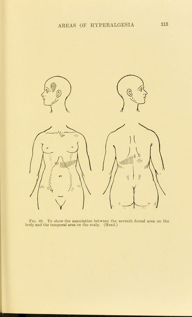 Fig. 89. To show the association between the seventh dorsal area