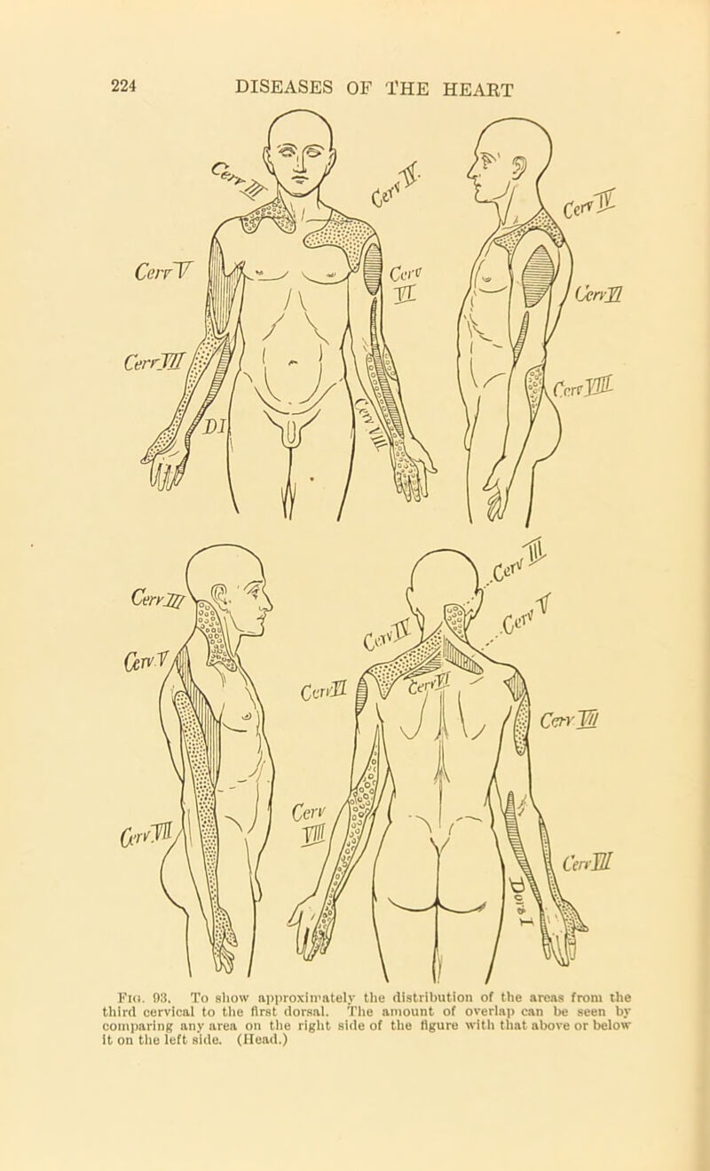 Fig. 03. To show approximately the distribution of the areas from the third cervical to the first dorsal. The amount of overlap can be seen by comparing any area on the right side of the figure with that above or below it on the left side. (Head.)