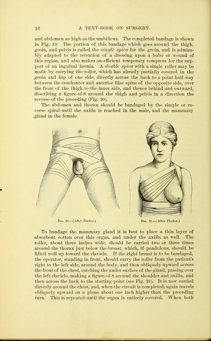 and abdomen as higli as the umbilicus. The completed bandage is shown in Fig, 19. The portion of this bandage which goes around the thigh, groin, and pelvis is called the single spica for the groin, and is admira- bly adapted to the retention of a dressing upon a bubo or wound of this region, and also makes an efficient temporary compress for the sup- port of an inguinal hernia. A double spica with a single roller may be made by carrying the roller, which has already partially covered in the groin and hip of one side, directly across the back to a point half-way between the trochanter and anterior iliac spine of the opposite side, over the front of the thigh to the inner side, and thence behind and outward, describing a figure-of-8 around the thigh and pelvis in a direction the reverse of the preceding (Fig. 20). The abdomen and thorax should be bandaged by the simple or re- verse spiral until the axilla is reached in the male, and the mammary gland in the female. Fig. 20.—(After Fischer.) Fig. 21.—(After Fischer.) To bandage the mammary gland it is best to place a thin layer of absorbent cotton over this organ, and under the axilla as well. The roller, about three inches wide, should be carried two or three times around the thorax Just below the breast, which, if pendulous, should be lifted well up toward the clavicle. If the right breast is to be bandaged, the operator, standing in front, should carry the roller from the patient's right to the left side, around the body, and then obliquely upward across the front of the chest, catching the under surface of the gland, passing over the left clavicle, making a figure-of-8 around the shoulder and axilla, and then across the back to the starting-point (see Fig. 21). It is now carried directly around the chest, and, when the circuit is completed, again travels obliquely upward on a plane about one inch higher than the preceding turn. This is repeated until the organ is entirely covered. When both