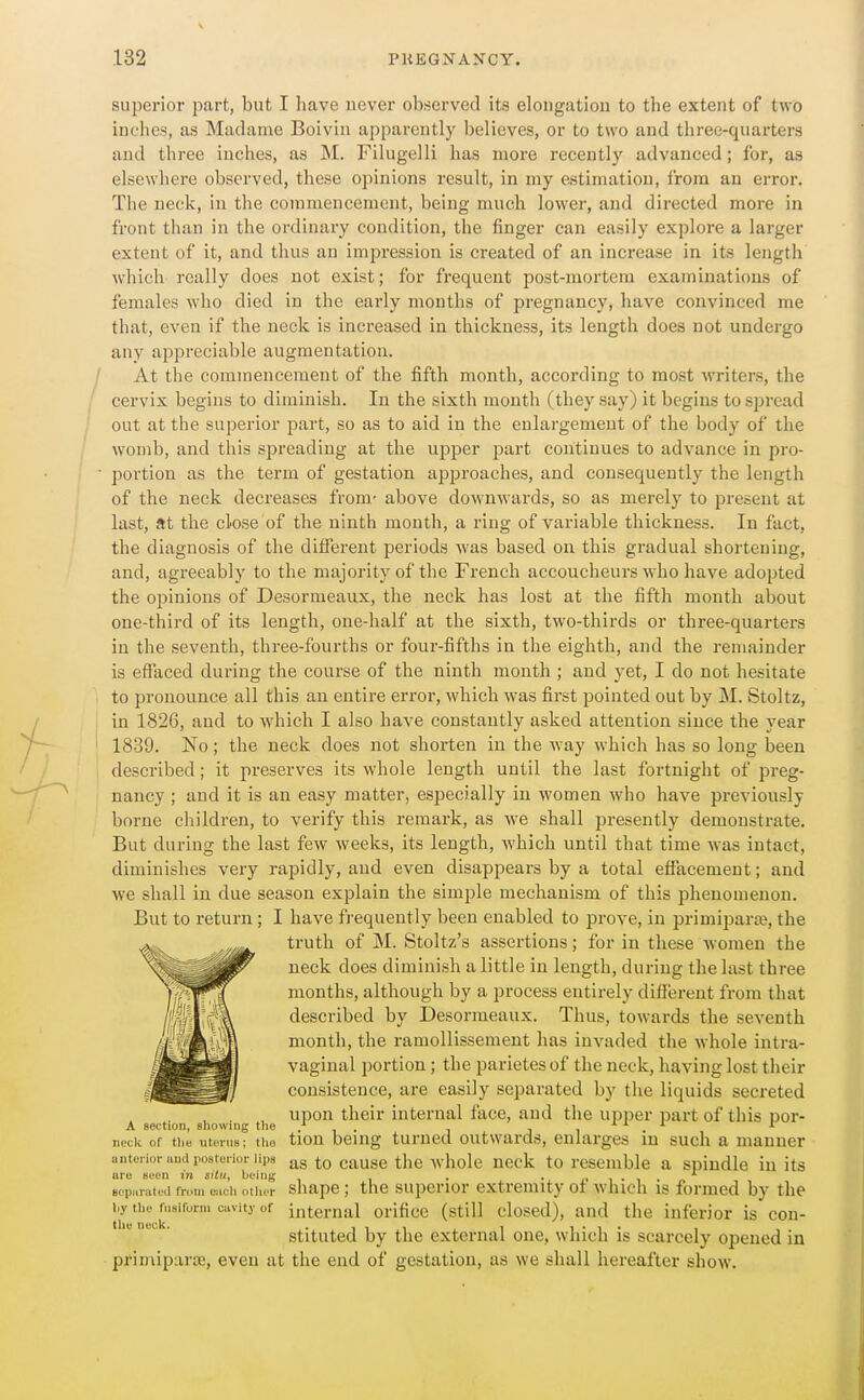 superior part, but I liave never observed its elongation to the extent of two inches, as Madame Boivin apparently believes, or to two and three-quarters and three inches, as M. Filugelli has more recently advanced; for, as elsewhere observed, these opinions result, in my estimation, from an error. The neck, in the commencement, being much lower, and directed more in front than in the ordinary condition, the finger can easily explore a larger extent of it, and thus an impression is created of an increase in its length which really does not exist; for frequent post-mortem examinations of females who died in the early months of pregnancy, have convinced me that, even if the neck is increased in thickness, its length does not undergo any appreciable augmentation. At the commencement of the fifth month, according to most writers, the cervix begins to diminish. In the sixth month (they say) it begins to spread out at the superior part, so as to aid in the enlargement of the body of the womb, and this spreading at the upper part continues to advance in pro- portion as the term of gestation approaches, and consequently the length of the neck decreases from- above downwards, so as merely to present at last, at the close of the ninth month, a ring of variable thickness. In fact, the diagnosis of the different periods was based on this gradual shortening, and, agreeably to the majority of the French accoucheurs who have adopted the opinions of Desormeaux, the neck has lost at the fifth month about one-third of its length, one-half at the sixth, two-thirds or three-quarters in the seventh, three-fourths or four-fifths in the eighth, and the remainder is effaced during the course of the ninth month ; and yet, I do not hesitate to pronounce all this an entire error, which was first pointed out by M. Stoltz, in 1826, and to which I also have constantly asked attention since the year 1839. No; the neck does not shorten in the way which has so long been described; it preserves its whole length until the last fortnight of preg- nancy ; and it is an easy matter, especially in women who have previously borne children, to verify this remark, as we shall presently demonstrate. But during the last few weeks, its length, which until that time was intact, diminishes very rapidly, and even disappears by a total effacement; and we shall in due season explain the simple mechanism of this phenomenon. But to return; I have frequently been enabled to prove, in primiparos, the truth of M. Stoltz's assertions; for in these women the neck does diminish a little in length, during the last three months, although by a process entirely different from that described by Desormeaux. Thus, towards the seventh month, the ramollissemeut has invaded the whole intra- vaginal portion; the parietesof the neck, having lost tlieir consistence, are easily separated by the liquids secreted , . , upon their internal face, and the upper part of this uor- A section, sliowing tlio * . ji neck of tiiu uterus; the tion bciug turued outwards, enlarges in such a manner antoi ior and posterior lips to causc the wholc ncck to rcsemblc a spindle in its lire seen in sitii, being . • I^ \ • i • sopurated from each otiur shapc; the supcrior extremity ot which is formed by the i.y the fiisiforni cavity of internal orificc (still closed), and the inferior is con- stituted by the external one, which is scarcely opened in primiparjE, even at the end of gestation, as we shall hereafter show.