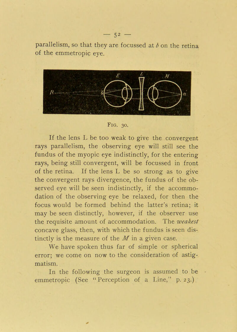 parallelism, so that they are focussed at b on the retina of the emmetropic eye. Fig. 30. If the lens L be too weak to give the convergent rays parallelism, the observing eye will still see the fundus of the myopic eye indistinctly, for the entering rays, being still convergent, will be focussed in front of the retina. If the lens L be so strong as to give the convergent rays divergence, the fundus of the ob- served eye will be seen indistinctly, if the accommo- dation of the observing eye be relaxed, for then the focus would be formed behind the latter’s retina; it may be seen distinctly, however, if the observer use the requisite amount of accommodation. The weakest concave glass, then, with which the fundus is seen dis- tinctly is the measure of the J/ in a given case. We have spoken thus far of simple or spherical error; we come on now to the consideration of astig- matism. In the following the surgeon is assumed to be emmetropic (See “Perception of a Line,” p. 23.)