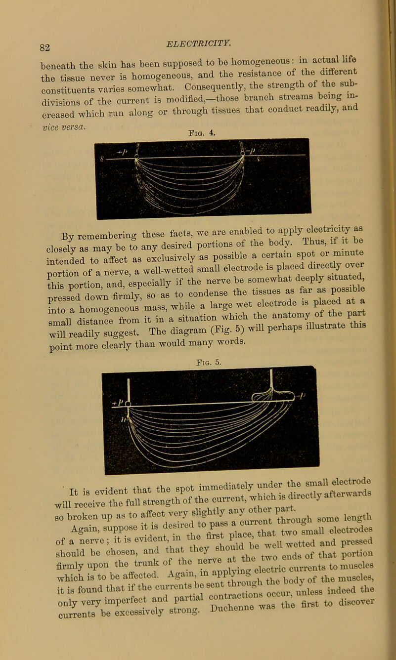 beneath the skin has been supposed to be homogeneous: in actual life the tissue never is homogeneous, and the resistance of the different constituents varies somewhat. Consequently, the strength of the sub- divisions of the current is modified,—those branch streams being in- creased which run along or through tissues that conduct readily, and vice versa. Fig. 4. By remembering these facts, we are enabled to apply^ctricity as closely as may be to any desired portions of the body. Thus, if it intended to affect as exclusively as possible a certain spot or minute portion of a nerve, a well-wetted small electrode is placed directly ove this portion and, especially if the nerve be somewhat deeply situated, pressed down firmly so as to condense the tissues as far as possible Lo a homogeneous mass, while a large wet electrode is placed at small distance from it in a situation which the anatomy of the part “u reggest. The diagram (Fig. 5) will perhaps rUustrate O. point more clearly than would many words. of a nerve; it is evident in J ^ be well wetted and pressed should be chosen, and that they portion firmly upon the trunk of the nerve toLscles which is to be affected. Again, m aPP ^ ^ d 0f the muscles, it is found that if the currents be sent th «gh ^ody^ ^ ^ only very imperfect and paitm con - first to discover currents be excessively strong. Duchenne w
