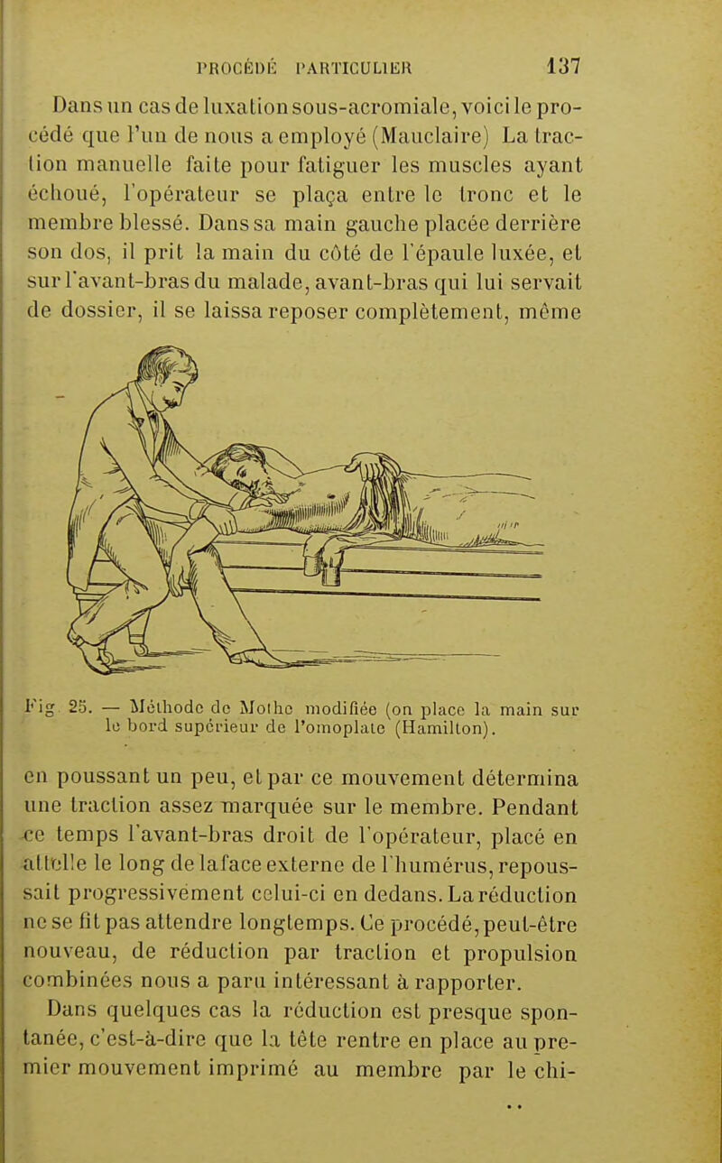 Dans un cas de luxation sous-acromiale, voici le pro- cédé que l'un de nous a employé (Mauclaire) La trac- lion manuelle faite pour fatiguer les muscles ayant échoué, l'opérateur se plaça entre le tronc et le membre blessé. Dans sa main gauche placée derrière son dos, il prit la main du côté de l'épaule luxée, et surTavant-brasdu malade, avant-bras qui lui servait de dossier, il se laissa reposer complètement, même Fig 25. — Méthode de Mollie modifiée (on place la main sui? le bord supérieur de l'omoplale (Hamilton). en poussant un peu, et par ce mouvement détermina une traction assez marquée sur le membre. Pendant ce temps l'avant-bras droit de l'opérateur, placé en ^ttielle le long de laface externe de l'humérus, repous- sait progressivement celui-ci en dedans. La réduction ne se fit pas attendre longtemps. Ce procédé, peut-être nouveau, de réduction par traction et propulsion combinées nous a paru intéressant à rapporter. Dans quelques cas la réduction est presque spon- tanée, c'est-à-dire que la tête rentre en place au pre- mier mouvement imprimé au membre par le chi-