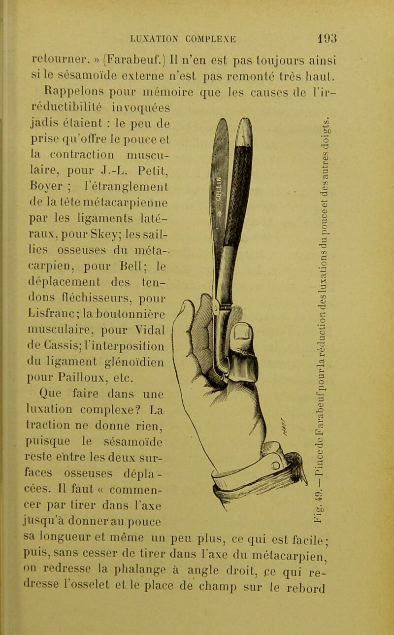 rclourner. » (Favabeuf.) Il n'en est pas toujours ainsi si le sésamoïde externe n'est pas remonté très haut. Rappelons pour mémoire que les causes de l'ir- réductibililé invoquées jadis étaient : le peu de prise qu'offre le pouce et la contraclion muscu- laire, pour J.-L. Petit, Boyer ; l'étranglement de la té te métacarpienne par les ligaments laté- raux, pour Skey; les sail- lies osseuses du méta- carpien, pour Bell; le déplacement des ten- dons fléchisseurs, pour Lisfranc ; la boutonnière musculaire, pour Vidal de Cassis; l'interposition du ligament glénoïdien pour Pailloux, etc. Que faire dans une luxation complexe? La traction ne donne rien, puisque le sésamoïde reste entre les deux sur- faces osseuses dépla- cées. Il faut « commen- cer par tirer dans l'axe jusqu'à donner au pouce sa longueur et même un peu plus, ce qui est facile- puis, sans cesser de tirer dans l'axe du métacarpien on redresse la phalange à angle droit, pe qui re- dresse l'osselet et le place de cham]) sur le rebord