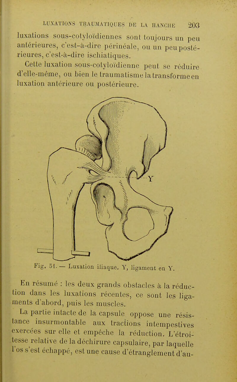 luxations sous-co(yloïdiennes sonl Loujours un peu antérieures, cesl-à-dire périnéale, ou un peu posté- rieures, c'est-à-dire ischiatiques. Cette luxation sous-cotyloïdienne peut se réduire d'elle-même, ou bien le traumatisme la transforme en luxation antérieure ou postérieure. Fig. 51. — Luxation iliaque. Y, ligament en Y. En résumé : les deux grands obstacles à la réduc- tion dans les luxations récentes, ce sont les liga- ments d'abord, puis les muscles. La partie intacte de la capsule oppose une résis- tance insurmontable aux tractions intempestives exercées sur elle et empêche la réduction. L'étroi- -lesse relative de la déchirure capsulaire, par laquelle l'os s'est échappé, est une cause d'étranglement d'au-