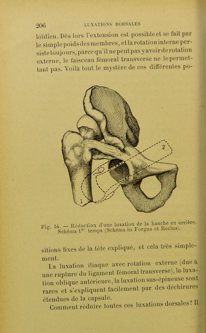 loïdicn. Dès lors l'extension esl possible et se fait par le simplcpoidsdesmembres,etlarolalioninlerneper- siste toujours, parce qu' il ne peut pas y avoir de rotation externe, le faisceau fémoral transverse ne le permet- tant pas. Voilà tout le mystère de ces différentes po- Fi„ 54 - Réduction crime luxation de la hanche en arrière. Schéma 1<='' temps (Schéma in Forgue et Reclus). sitions fixes de la tète expliqué, et cela très simple- ment. ^ ,• 1 ^ X La luxation iliaque avec rotation externe ^due a une rupture du ligament fémoral transverse), la luxa- tion oblique antérieure, la luxation sus-épineuse sont rares et s'expliquent facilement par des déchirures étendues de la capsule. Comment réduire toutes ces luxations dorsales. U