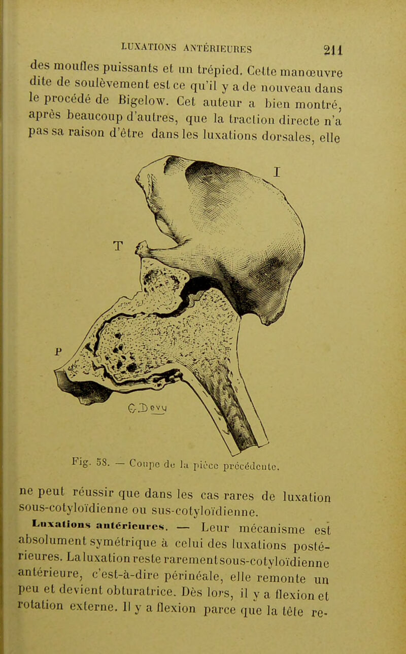des mounes puissants et un trépied. CeUe manœuvre dite de soulèvement est ce qu'il y a de nouveau dans le procédé de Bigelow. Cet auteur a bien montré, après beaucoup d'autres, que la traction directe n'a pas sa raison d'être dans les luxations dorsales, elle Fig. 58. — Coiijic de la pii-cc prccédculc. ne peut réussir que dans les cas rares de luxation sous-cotyloïdienne ou sus-cotyloïdienne. Luxations autériciircs. — Leur mécanisme est absolument symétrique à celui des luxations posté- rieures. Laluxation reste rarementsous-cotyloïdienne antérieure, c'est-à-dire périnéale, elle remonte un peu et devient obturatrice. Dès lors, il v a flexion et