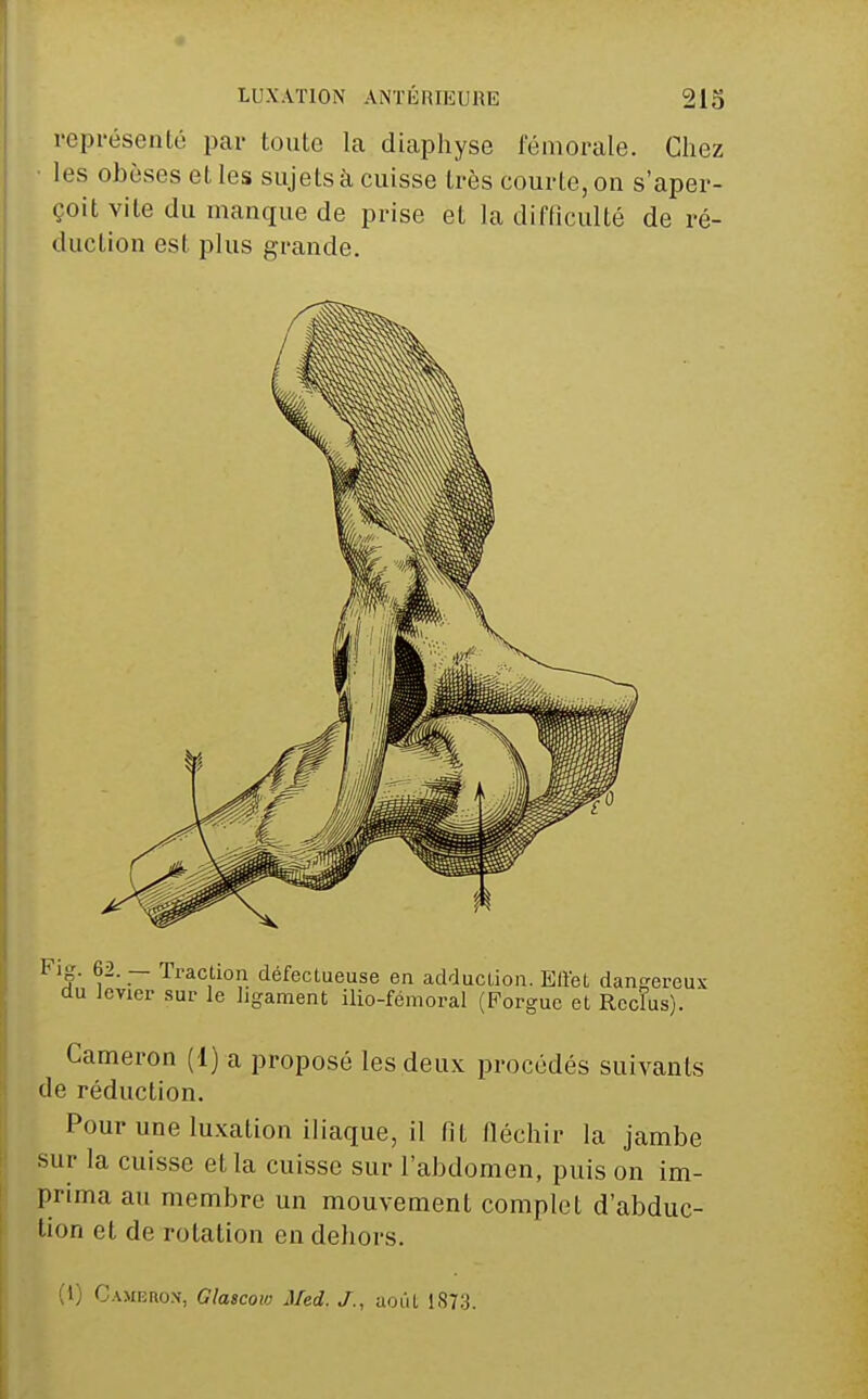 vcpi'ésenté par toute La diaphyse fémorale. Chez les obèses et les sujets à cuisse très courte, on s'aper- çoit vite du manque de prise et la difficulté de ré- duction est plus grande. Cameron (1) a proposé les deux procédés suivants de réduction. Pour une luxation iliaque, il fit fiéchir la jambe sur la cuisse et la cuisse sur l'abdomen, puis on im- prima au membre un mouvement complet d'abduc- tion et de rotation en dehors. (1) Cameron, Glaicow Med. J., uoiU 1873.