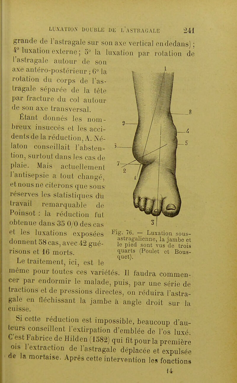 LUXATION bULULli Dli I.'asTHACAM' Ml grande de l'asU-agale sur son axe vertical en dedans) ; 4Muxation externe ; 3 la luxation par rotation de l'astragale autour de sou axe antéro-postérieur ; G la rotation du corps de l'as- Iragale séparée de la tète par fracture du col autour de son axe transversal. Étant donnés les nom- breux insuccès et les acci- dents de la réduction, A. Né- laton conseillait l'absten- tion, surtout dans les cas de plaie. Mais actuellement l'antisepsie a tout changé, etnousne citerons que sous réserves les statistiques du travail remarquable de Poinsot : la réduction fut obtenue dans ^3 0/0 des cas et les luxations exposées donnent 58 cas, avec 42 gué- risons et 16 morts. Le traitement, ici, est le même pour toutes ces variétés. Il faudra commen- cer par endormir le malade, puis, par une série de tractions et de pressions directes, on réduira l'astra- gale en Qéchissant la jambe à angle droit sur la cuisse. Si cette réduction est impossible, beaucoup d'au- teurs conseillent l'extirpation d'emblée de l'os luxé C'est Fabrice de Hilden (1382) qui fit pour la première OIS 1 extraction de l'astragale déplacée et expulsée • de la mortaise. Après cette intervention les fonctions 14 Fig. 76. — Luxation sous- astragalienne, la jambe et le pied sont vus de trois quarts (Poulet et Bous- quet).