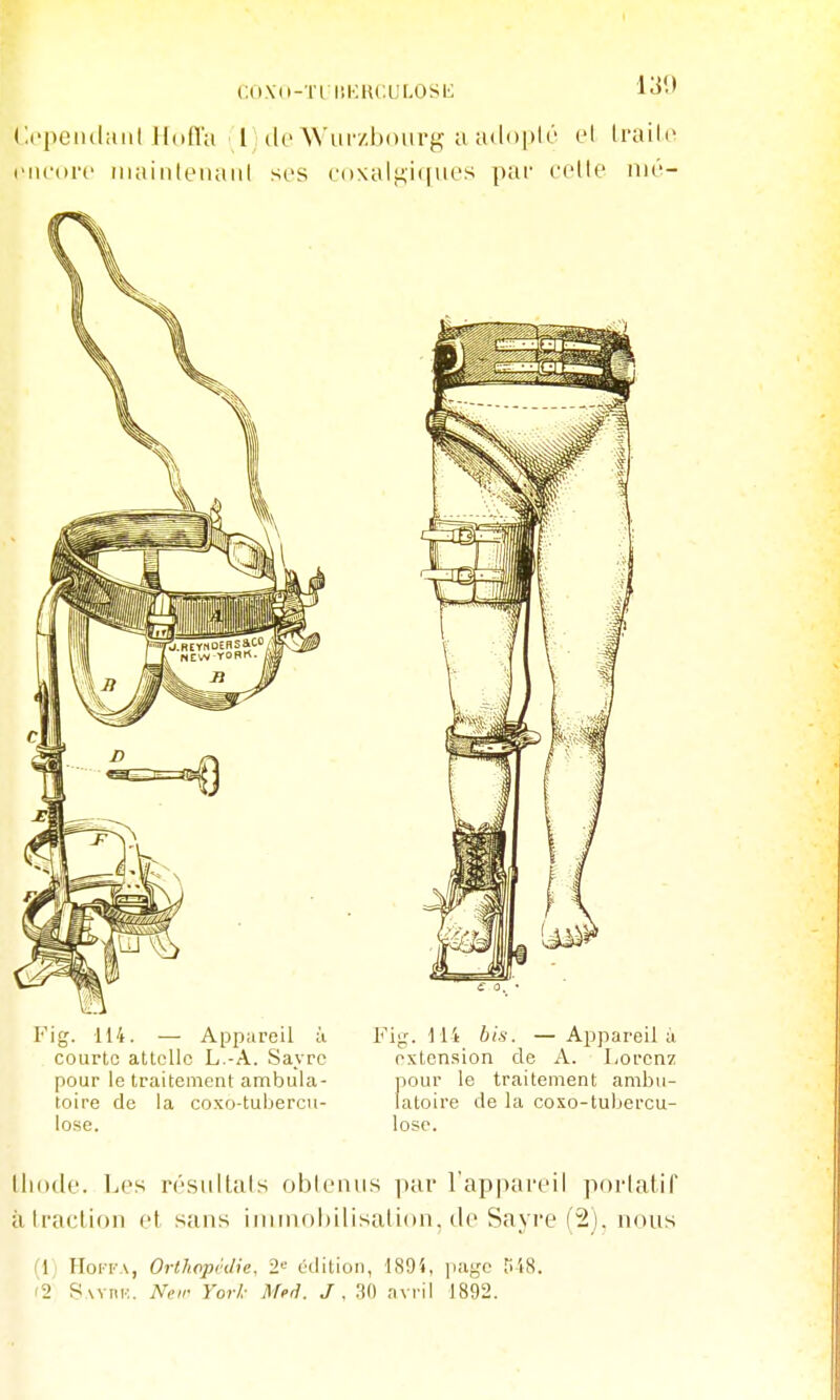 CO.Vd-Tri'.KKC.L'LOSL: 130 Opeiulaiil llofla l] do Wiir/boiirg a adoplô el Irailo l'iH'di'c inaiiilenanl ses t'o\ali!;i(iuos par colle niô- Fig. 114. — Appareil à courte attelle L.-A. Sayrc pour le traitement ambula- toire de la coxo-tubercu- losc. Fi'^. Mi bis. — Appareil à extension de A. Lorcnz pour le traitement ambu- latoire de la coxo-tuljercu- lose. lliodo. Les résultats oblemis par l'apparoil portatif à traction et sans ininK)l)ilisalion, de Sayro (2). nous (1; HoiTA, Orthopïilie, 2-' édition, 1894, page tiiS. 'i SAYnu. New York Meâ. J , 30 avril 1892.