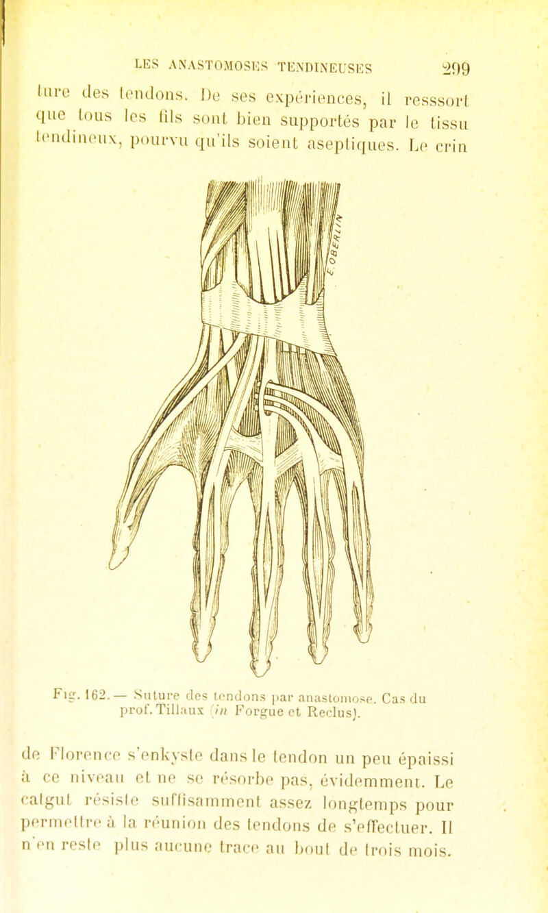 luro des tondons. De ses expériences, il resssorl, qne lous les Ris sont bien supportés par le tissu tendineux, pourvu qu'ils soient aseptiques. Le crin Fier. 162.— .Suture des iondûn.s par aiuistonio?;e. Cas du l)ror. Till.uix in Forgue et Reclu.si. de Florence s'enkyslc dans le tendon un peu épaissi à ce niveau et ne se résorbe pas, évidemment. Le calf^nt résisl. snnisainmenl assez longtemps pour pcrinelircù la réunion des tendons de s'effecluer. Il n'en reste plus aucune trace au boni de trois mois.