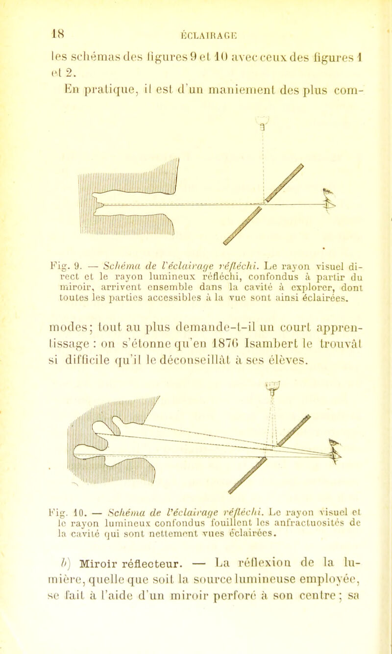 les schémas des ligures 9 et 10 avec ceux des figures 1 et 2. En pratique, il est d'un maniemenl des plus com- r' Fig. 9. —■ Schéma de Véclairage réflécli't. Le rajon visuel di- rect et le rayon lumineux réfléchi, confondus à partir du miroir, arrivent ensemble dans la cavité à explorer, dont toutes les parties accessibles à la vue sont ainsi éclairées. modes; tout au plus demande-l-il un court appren- tissage : on s'étonne qu'en 187G Isambert le trouvai si difficile qu'il le déconseillât à ses élèves. Kig. 10. — Scliému de l'éclairage réfléc/ii. Le rayon visuel et lo rayon lumineux conCondus fouillent les anfractuositcs de la cavité (jui sont nettement vues éclairées. /') Miroir réflecteur. — La réflexion de la lu- mière, quelle que soit la source lumineuse employée, se fait à l'aide d'un mircur perforé à son centre; sa