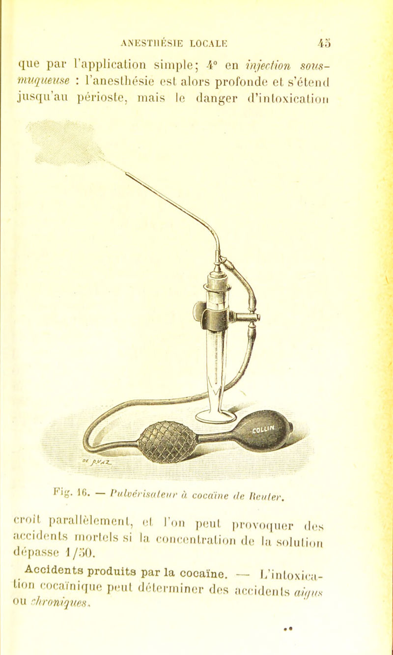 ANESTlIl'îSlE LOCALK 4o que par l'applicalion simple; -4° en injecUon sons- muqueuse : l'anesLliésie esl alors profonde et s'étend jusqu'au périoste, mais le danger d'intoxication Fig. 16. — l'ulvérisolei/r à cocaïne de. Ttciiler. croit parallèlement, (,t T.,,, p,.„| ,,n)v,„|„(!r des accidents mortels si la .omMMitration de |;i solution d(!passe i j'M). Accidents produits par la cocaïne. — l/intoxica- Lion cocaïnique peut déterminer des accidents ahjus ou rhroniqufis.