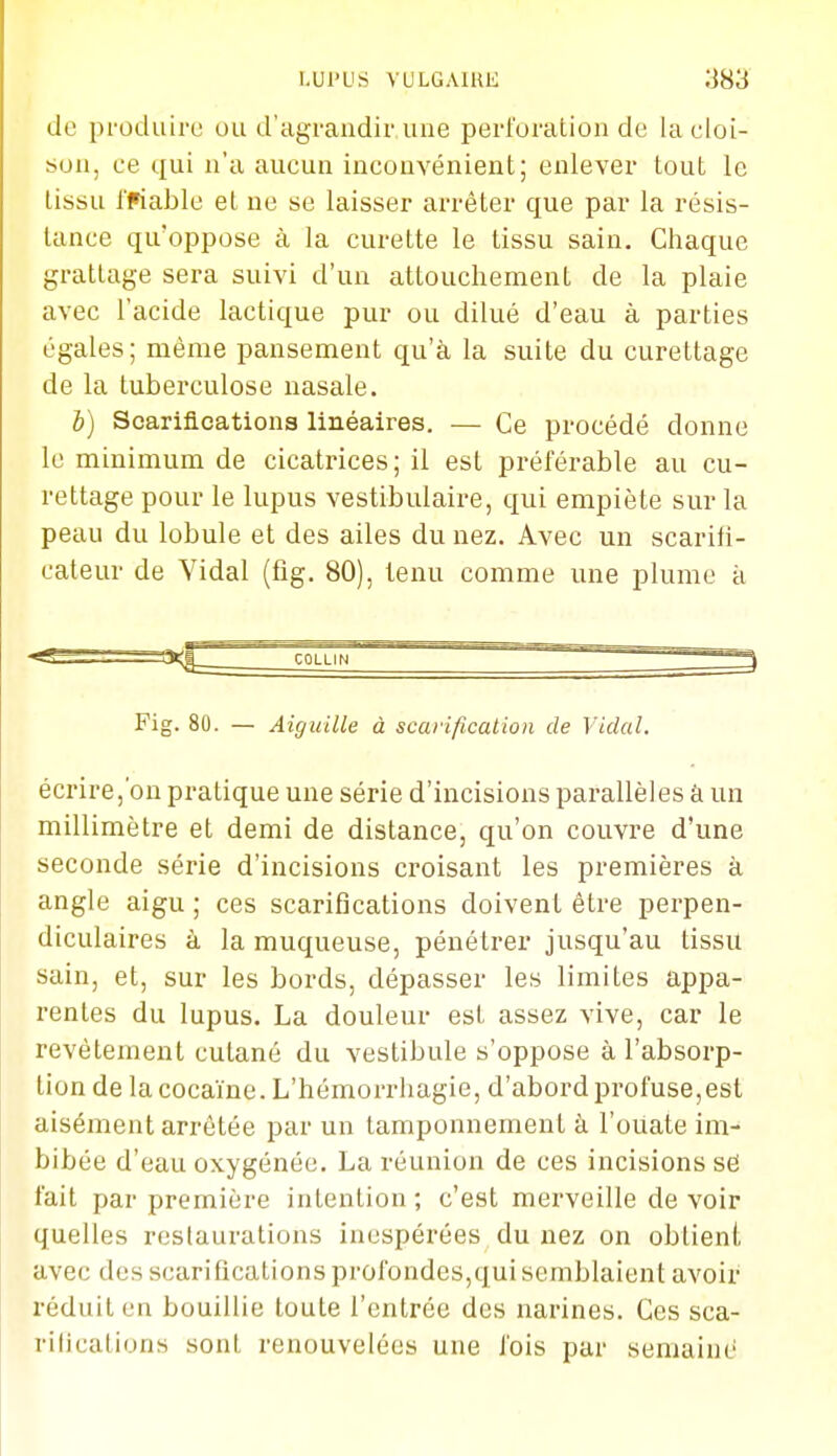 de pi'oduire ou d'agrandir une perforation de la cloi- son, oe qui n'a aucun inconvénient; enlever tout le tissu i'Fiable et ne se laisser arrêter que par la résis- tance qu'oppose à la curette le tissu sain. Chaque grattage sera suivi d'un attouchement de la plaie avec l'acide lactique pur ou dilué d'eau à parties égales; même pansement qu'à la suite du curettage de la tuberculose nasale. b) Scariacations linéaires. — Ce procédé donne le minimum de cicatrices; il est préférable au cu- rettage pour le lupus vestibulaire, qui empiète sur la peau du lobule et des ailes du nez. Avec un scarifi- cateur de Vidal (fig. 80), tenu comme une plume à <ff — ...-r-iy^_^^^^coLLiN' ~ ' Fig. 80. — Aiguille à scaiification de Vidal. écrire,'on pratique une série d'incisions parallèles à un millimètre et demi de distance, qu'on couvre d'une seconde série d'incisions croisant les premières à angle aigu ; ces scarifications doivent être perpen- diculaires à la muqueuse, pénétrer jusqu'au tissu sain, et, sur les bords, dépasser les limites appa- rentes du lupus. La douleur est assez vive, car le revêtement cutané du vestibule s'oppose à l'absorp- tion de la cocaïne. L'hémorrhagie, d'abord pi-ofuse,est aisément arrêtée par un tamponnement à l'oiiate im- bibée d'eau oxygénée. La réunion de ces incisions së fait par première intention ; c'est merveille de voir quelles restaurations inespérées du nez on obtient avec des scarifications profondes,qui semblaient avoir réduit en bouillie toute l'entrée des narines. Ces sca- rifications sont renouvelées une fois par semaine