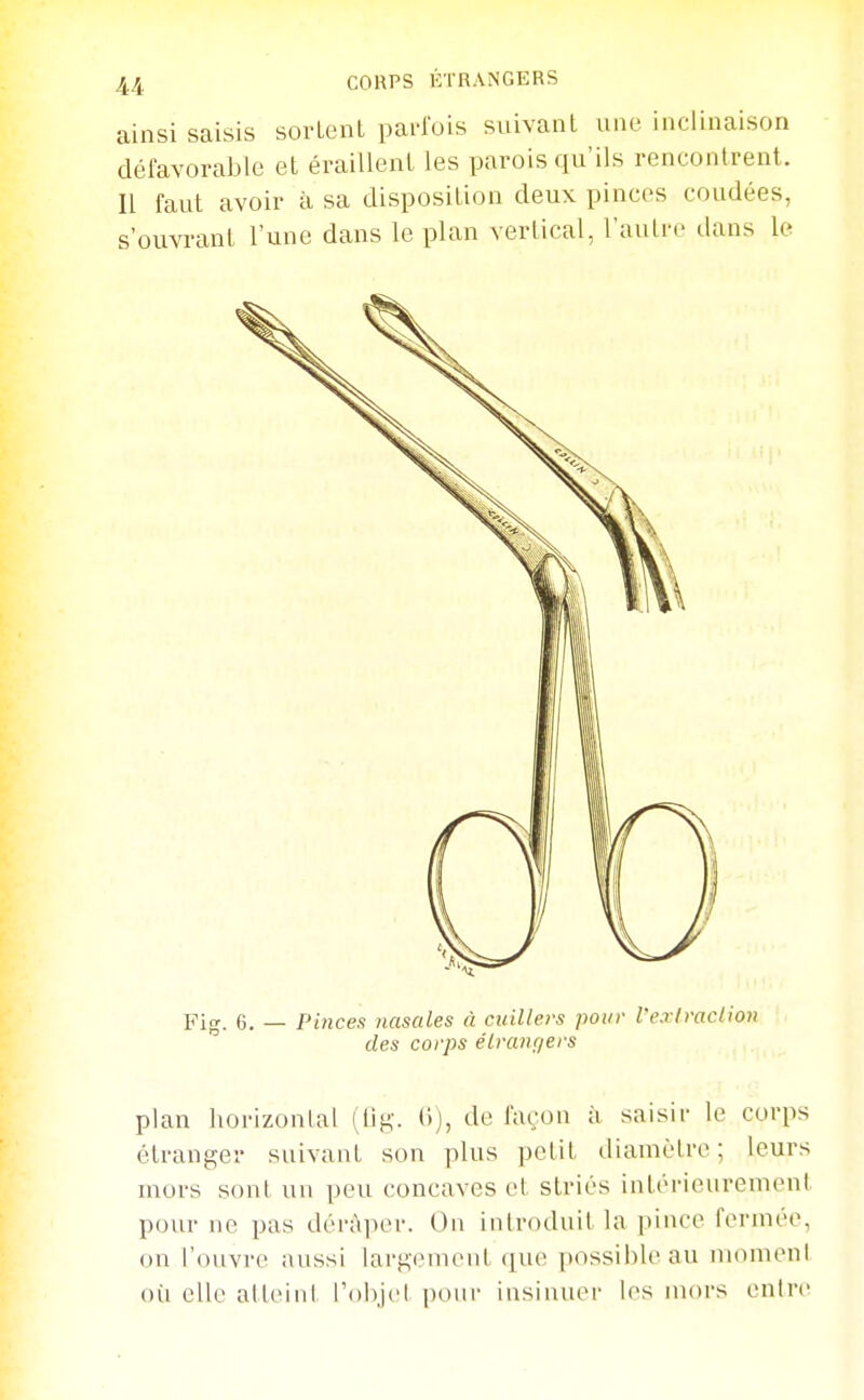 ainsi saisis sortent pai'iois suivant une inclinaison délavorable et érailleni les parois qu'ils rencontrent. Il faut avoir à sa disposition deux pinces coudées, s'ouvrant l'une dans le plan vertical, l'aulrc dans le Fig. 6. — Pinces nasales à cuillers pour rexlraclion des corps étrangers plan horizontal (lig. (i), de façon à saisir le corps étranger suivant son plus petit diamètre ; leurs mors sont un peu concaves et striés intérieurement pour ne pas dérà])er. On introduit la pince ferniéo, on l'ouvre aussi largcmeni (]ue ])Ossible au niomenl oii elle atlcinl l'objet i)our insinuer les mors entre