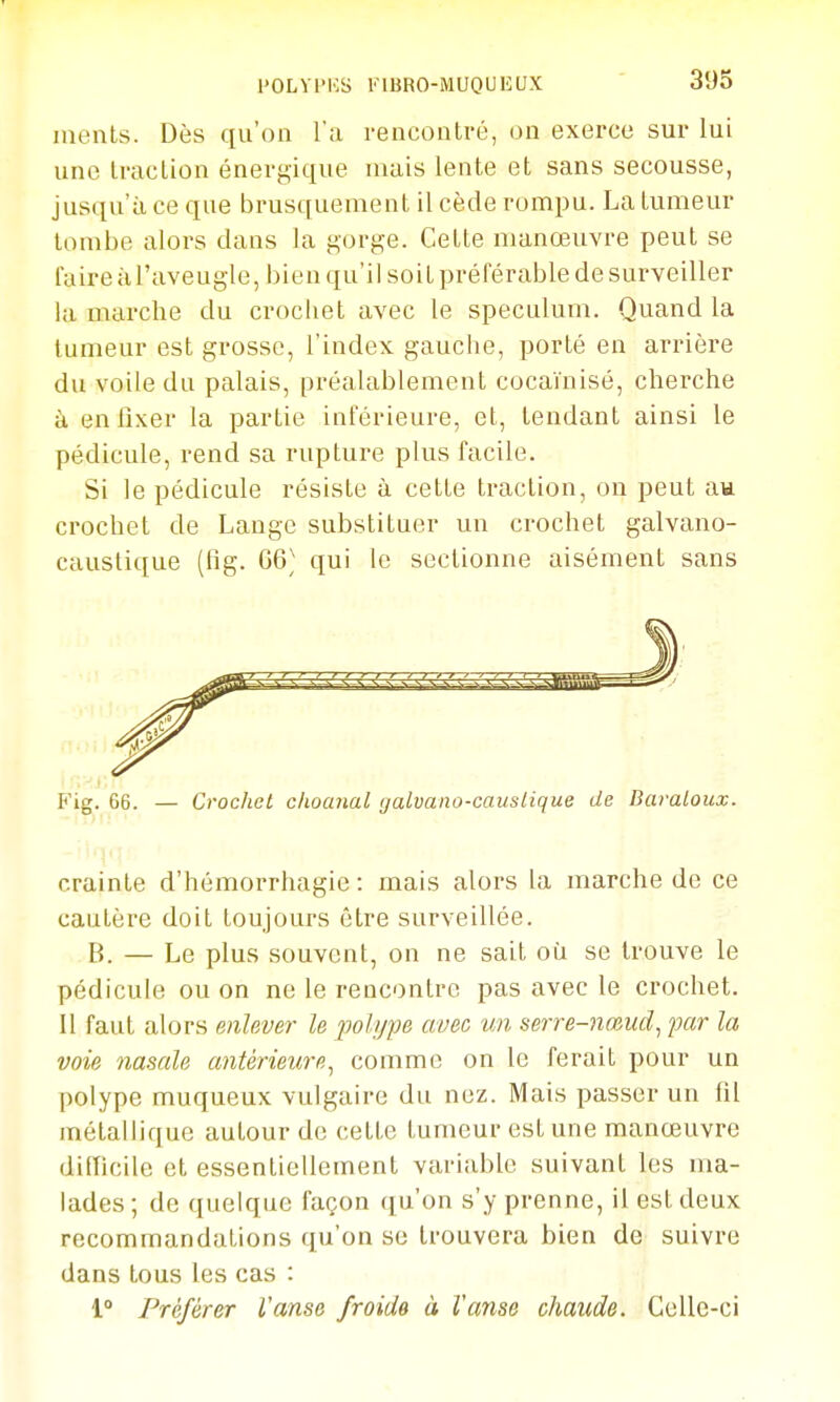 nienls. Dès qu'on l'a rencontré, on exerce sur lui une Iraclion énergique niais lente et sans secousse, jusqu'à ce que brusquement il cède rompu. La tumeur tombe alors dans la gorge. Cette manœuvre peut se faire àl'aveugle, bien qu'il soit préférable de surveiller la marche du crochet avec le spéculum. Quand la tumeur est grosse, l'index gauche, porté en arrière du voile du palais, préalablement cocaïnisé, cherche à en fixer la partie inférieure, et, tendant ainsi le pédicule, rend sa rupture plus facile. Si le pédicule résiste à cette traction, on peut au crochet de Lange substituer un crochet galvano- caustique (fig. 66^^ qui le sectionne aisément sans Fig. 66. — Crochet choanal (jalvano-causLique de Baraloux. crainte d'hémorrhagie : mais alors la marche de ce cautère doit toujours être surveillée. B. — Le plus souvent, on ne sait où se trouve le pédicule ou on ne le rencontre pas avec le crochet. Il faut alors enlever le polijpe avec un serre-nœud^ par la voie nasale antérieure^ comme on le ferait pour un polype muqueux vulgaire du nez. Mais passer un fil métallique autour de cette tumeur est une manœuvre difficile et essentiellement variable suivant les ma- lades ; de quelque façon ([u'on s'y prenne, il est deux recommandations qu'on se trouvera bien de suivre dans tous les cas : 1° Préférer l'anse froide à Vanse chaude. Celle-ci