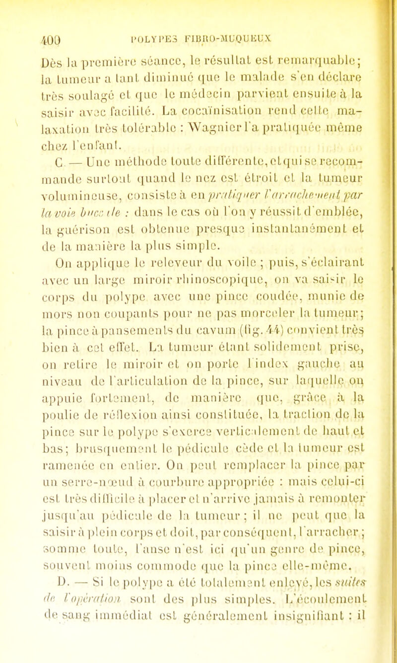 40y l'oLYi'iis rimio-jiuQuiiLX Dès lu pi'omièro séance, le résullaL est reiiiurqual)le ; la luineui- a lanl dluiinuc que le malade s'en déclare très soulagé cl que le médecin pai-vlenl ensuite à la saisir avac facilité. La cocaïnisation rend celle ma- laxaliou très tolérable : Wagnicr Ta pralnjuce même chez ronFanl. C. — Une méthode toute ditrérente,ctqui se recom- mande surtout (]uand le nez est étroit cl la tumeur volumineuse, consiste à an pratiqua- VarraclLe-nent par lavoin huer. île : dans le cas où l'on y réussit d'emblée, la guérison est obtenue presque instantanément et de la manière la plus simple. On applique le releveur du voile ; puis, s'éclairanl avec un large miroir rliinoscopique, on va saisir le corps du polype avec une pince coudée, munie de mors non coupants pour ne pas morceler la tumeur; la pince à pansements du cavum (lig. 4i) convient très bien à col effet. La tumeur étant solidement prise, on retire le miroir et on porte l index gauche au niveau de l'arliculalion de la pince, sur laquelle on appuie l'ortemenl, de manière que. grâce à la poulie de réflexion ainsi conslituée, la traclion de la pince sur le polype s'exerce verticilomenl de haut et bas; brusquement le pédicule cède et la iumeur est ramenée en cnlier. On peut remplacer la pince par un serre-nœud à courbure appropriée : mais celui-ci est très dillicile à placer et n'arrive Jamais à remontei jusqu'au pédicule de l:i lunuuir ; il ne peut que la saisir à ])lein corps et doit, par conséquent, l'arracher ; somme toute, l'anse n'est ici qu'an genre de pince, souvent moins commode que la pinça elle-même. D. — Si le polype a élé tolalemant enlevé, les s/f/^fs- (le /'opèn//io;i sonl des plus simples. L'écoulement de sang immédiat est généralement insignifiant : il