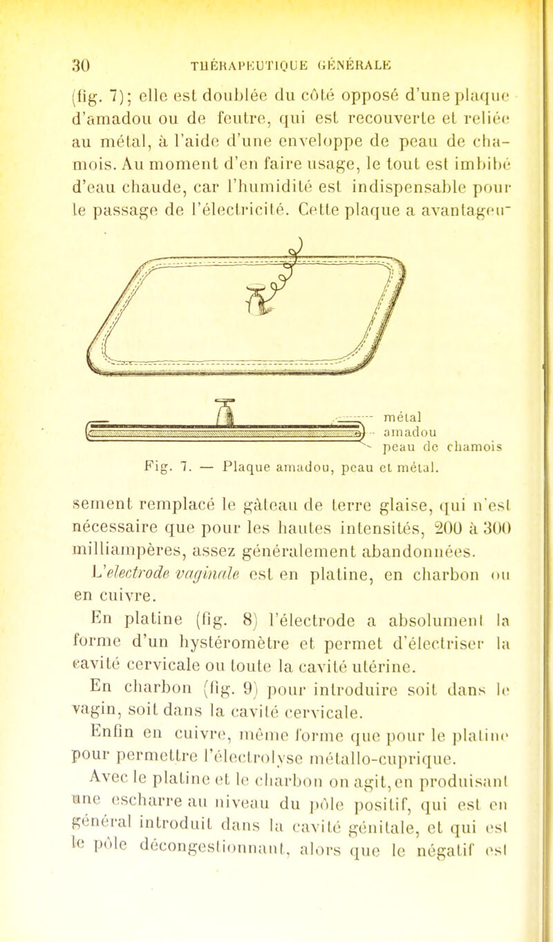 (flg. 7); elle est doublée du côté opposé d'une plaque d'amadou ou de feutre, qui est recouverte et reliée au métal, à l'aide d'uue enveloppe de peau de cha- mois. Au moment d'en faire usage, le tout est imbibé d'eau chaude, car l'humidité est indispensable pour le passage de l'électricité. Cette plaque a avantageir Fig. 1. — Plaque amadou, peau et métal. sèment remplacé le gâteau de terre glaise, qui n'est nécessaire que pour les hautes intensités, 200 à 300 milliampères, assez généralement abandonnées. L'électrode vaginale est en platine, en charbon «m en cuivre. En platine (fig. 8) l'électrode a absolument la forme d'un hystéromèlre et permet d'électriser la cavité cervicale ou toute la cavité utérine. En charbon (fig. 9} pour introduire soit dans le vagin, soit dans la cavité cervicale. Enfin en cuivre, même forme que pour le plalinc pour permettre l'électrolyse métallo-cuprique. Avec le platine et le charbon on agit,en produisant mne escharre au niveau du pôle positif, qui est en général introduit dans la cavité génitale, et qui es! te pôle décongeslionuaut. alors que le négatif esl