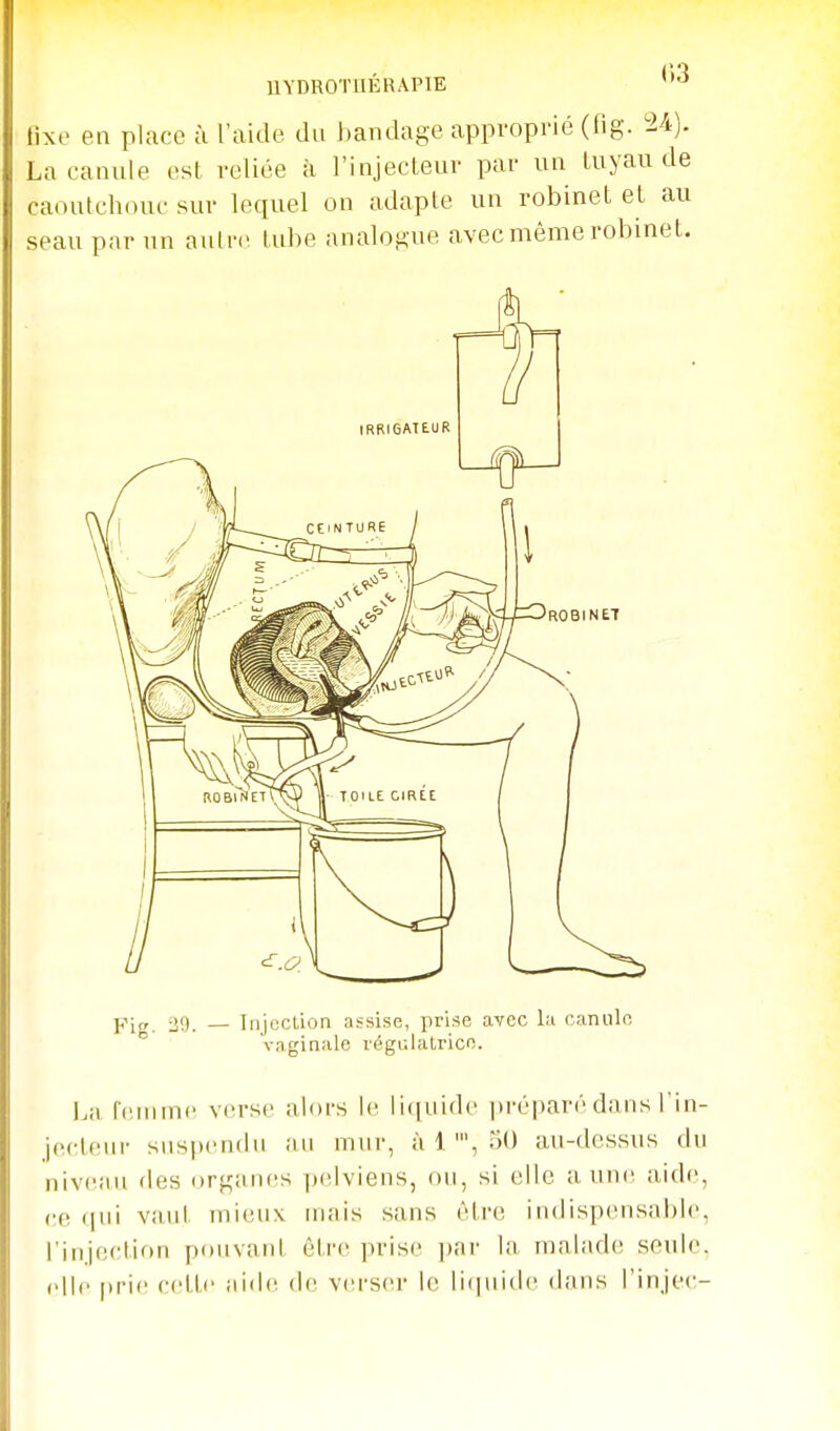 UYDROTIIÉRAPIE '^ fixe en place ù l'aide du l)andage approprié (fig. ^2-4). La canule est reliée à l'injecteur par un Luyau de caoutchouc sur lequel on adapte un robinet et au seau par un autre tube analogue avec même robinet. pi„ 29. — Iijjccliûn assise, prise avec la canule  vaginale tégclalrice. ]/,[ rcinmc verse alors le li(|uide jiréparé dans l'in- jecteur susi)en(lu au mur, à 1 ', TK) au-dessus du niv(Niu des organiis jxdviens, ou, si elle a uncï aide, ce <|ui v;uit mieux mais sans être indispensable, l'injectiftn pouvant être prise ])ar la malad(! seule, (>lic |iric cctti' ai<l(^ de verser le liipiide dans l'injec-