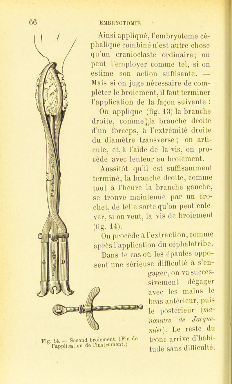 FiK 14. — Second broiement. (Fin do l'application do l'instrument.) Ainsi appliqué, l'embryolome cé- phalique combiné n'est autre chose qu'un cranioclaste ordinaire; on peut l'employer comme tel, si on estime son action suffisante. — Mais si on juge nécessaire de com- pléter le broiement, il faut terminer l'application de la façon suivante : On applique (fig. 13) la branche droite, comme j;la branche droite d'un forceps, à l'extrémité droite du diamètre transverse ; on arti- cule, et, à l'aide de la vis, on pro- cède avec lenteur au broiement. Aussitôt qu'il est suffisamment terminé, la branche droite, comme tout à l'heure la branche gauche, se trouve maintenue par un cro- chet, de telle sorte qu'on peut enle- ver, si on veut, la vis de broiement (fig. 14). On procède à l'extraction, comme après l'application du céphalotribe. Dans le cas où les épaules oppo- sent une sérieuse difficulté à s'en- gager, on va succes- sivement dégager avec les mains le bras antérieur, puis le postérieur {ma- imuvre de Jacque- mier). Le reste du tronc arrive d'habi- tude sans difficulté.