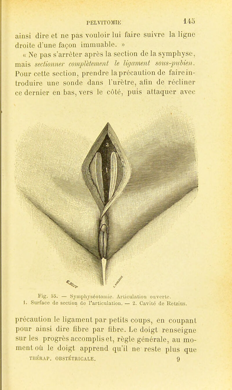 PELVITOMIK 143 ainsi dire et ne pas vouloir lui faire suivre la ligne droite d'une façon immuable. » « Ne pas s'arrêter après la section de la symphyse, mais sectionner complètement le ligament sous-pubien. Pour cette section, prendre la précaution de faire in- troduire une sonde dans l'urètre, afin de récliner ce dernier en bas, vers le côté, puis attaquer avec Fig. 03. — Symphyséotoniio. Aniculatiou ouvcrto. 1. Surface do section do l'articulation. — 2. Cavité de Rotzius. précaution le ligament par petits coups, en coupant pour ainsi dire fibre par fibre. Le doigt renseigne sur les progrès accomplis et, règle générale, au mo- ment où le doigt apprend qu'il ne reste plus que TIIÉRAP. OBSTÉTRICALE. 9