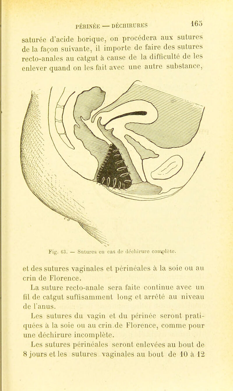 saturée d'acide borique, on procédera aux sutures de la façon suivante, il importe de faire des sutures recto-anales au catgut à cause de la difficulté de les enlever quand on les fait avec une autre substance, et des sutures vaginales et périnéales k la soie ou au crin de Florence. La suture recto-anale sera faite continue avec un fil de catgut suflisamment long et arrêté au niveau de l'anus. Les sutures du vagin et du périnée seront prati- quées il la soie ou au crin.de Florence, comme pour une déchirure incomplète. Les sutures périnéales seront enlevées au bout de 8 jours et les sutures vaginales au bout de 10 à 12