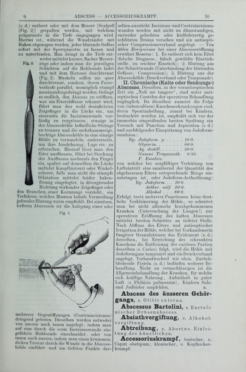 (s. d.) entleert oder mit dem Messer [Scalpell (Fig. 2)] gespalten werden, mit welchem präparando in die Tiefe eingegangen wird. Hierbei ist, während die Wundränder mit Haken abgezogen werden, jedes blutende Gefäss sofort mit der Sperrpincette zu fassen und zu unterbinden. Man dringt in die Tiefe ent- weder mittelst kurzer, flacher Messer- Fig- 2. züge oder indem man die jeweiligen Schichten auf die Hohlsonde ladet und mit dem Bistouri durchtrennt (Fig. 3). Muskeln sollen nie quer durchtrennt, sondern, ihrem Faser- verläufe parallel, womöglich stumpf auseinandergedrängt werden. Gelingt es endlich, den Abscess zu eröffnen, was am Eiterabflusse erkannt wird, führt man den wohl desinficirten Zeigefinger in die Lücke ein, um einerseits die Incisionswunde vor- läufig zu vergrössern, etwaige in der Abscesshöhle befindliche Stränge zu trennen und die mehrkammerige, buchtige Abscesshöhle in eine einzige Höhle zu verwandeln, andererseits, um ihre Ausdehnung, Lage etc. zu erforschen. Hierauf lässt man den Eiter ausfliessen, führt bei Stockung des Ausflusses nochmals den Finger ein, spaltet auf demselben die Lücke mittelst Knopfbistouri oder Winkel- scheere, falls man nicht die stumpfe Dilatation mittelst beider haken- förmig eingelegter, in divergirender Richtung wirkender Zeigefinger oder den Branchen einer Kornzange vorzieht, ein Verfahren, welches Mosetig behufs Vermeidung jedweder Blutung warm empfiehlt . Bei sinuösen, tieferen Abscessen ist die Anlegung einer oder Fig. 3. mehrerer Gegenöffnungen (Contraincisionen) dringend geboten. Dieselben werden entweder von aussen nach innen angelegt, indem man auf eine durch die erste Incisionswunde ein- geführte Hohlsonde einschneidet, oder von innen nach aussen, indem man einen krummen, dicken Troicar durch die Wunde in die Abscess- höhle einführt und am tiefsten Punkte der- selben aussticht. Incisions- und Contraincisions- wunden werden mit nicht zu dünnwandigen, entweder gelochten oder kielfederartig ge- schlitzten Drains versehen und ein antisepti- scher Compressionsverband angelegt. — Von üblen Ereignissen bei einer Abscesseröffnung erwähnt Mosetig : 1. Es entleert sich kein Eiter (falsche Diagnose, falsch gewählte Einstich- stelle, zu seichter Einstich); 2. Blutung aus der Schnittwunde (Unterbindung der blutenden Gefässe, Compression); 3. Blutung aus der Abscesshöhle (Druckverband oder Tamponade). II. Chronische (Kalte oder Senkungs-) Abscesse. Dieselben, in der vorantiseptischen Zeit ein „Noli me tangere“, sind unter anti- septischen Cautelen der operativen Behandlung zugänglich. Da dieselben zumeist die Folge von (tuberculösen) Knochenerkrankungen sind, deren Spontanheilung, zumal bei Kindern, beobachtet worden ist, empfiehlt sich vor der immerhin eingreifenden breiten Spaltung ein Versuch mit Punction und Aspiration (s. d.) und nachfolgender Einspritzung von Jodoform- emulsion : Rp. Jodoform, p 10-0. Glycerin 80’ 0. Aq. destill 20’ 0. Gummi Tragacanth. 0’50. F. Emulsio. von welcher bei sorgfältiger Verhütung von Lufteintritt eine annähernd der Quantität des abgelassenen Eiters entsprechende Menge ein- zubringen ist, oder Jodoform-Aetherlösung: Rp. Jodoform. . . 10’0. Aether. sulf. 20’0. Alkohol . . . 80’0. Erfolgt trotz mehrerer Punctionen keine deut- liche Verkleinerung der Höhle, so schreitet man bei nicht allzusehr herabgekommenen Kranken (Untersuchung der Lungen!) zur operativen Eröffnung des kalten Abscesses mittelst breiten Schnittes an tiefster Stelle. Nach Abfluss des Eiters und antiseptischer Irrigation der Höhle, welcher bei Vorhandensein fungöser Granulationen das Evidement (s. d.) derselben, bei Erreichung des erkrankten Knochens die Entfernung der cariösen Partien desselben (s. Caries) folgt, wird die Höhle mit Jodoformgaze tamponirt und ein Druckverband angelegt. Verbandwechsel wie oben. Zurück- bleibende Fisteln (s. d.) bedürfen weiterer Be- handlung. Nicht zu vernachlässigen ist die Allgcmeinbehandlung der Kranken, für welche sich kräftige Nahrung, Aufenthalt in guter Luft (s. Phthisis pulmonum), Kindern Salz- und Jodbäder empfehlen. b. Abscess des äusseren Gehör- gangs, s. Otitis externa. Abscessus Bartolini, s. Bartoii- nischer Drüsenabscess. Absinthvergiftung, s. Alkohol- vergiftung. Abtreibung, s. Abortus. Einlei- tung des künstlichen. Accessoriuskrampf, tonischer, s. Caput obstipum; klonischer, s. Kopfnicker- krampf.