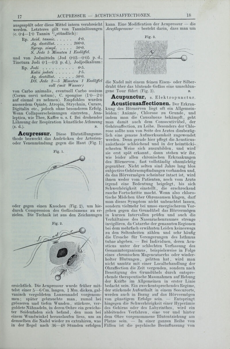 ACUPRESSUR — ACUSTICUSAFFECTIONEN. 18 ausgespült oder diese Mittel intern verabreicht werden. Letzteres gilt von Tanninlösungen (c. 0’4—l’O Tannin ^stündlich): Rp. Acid. tannic 4’0. Aq. destillat 200'0. Syrup. simpl. .... 50'0. S. Jede 5 Minuten 1 Esslöffel. und von Jodmitteln (Jod 0'03—0'05 p. d., Tinctura Jodi 01—0*3 p. d.), Jodjodkalium: Rp. Jodi 0-5. Kalii jodati 1'5. Aq. destillat 50'0. DS. Jede 2—5 Minuten 1 Esslöffel voll (mit Wasser) von Carbo animalis, eventuell Carbo ossium (Cornu cervi ustum), C. spongiae (l’O—2’0 auf einmal zu nehmen). Empfohlen wurden ausserdem Opiate, Atropin, Strychnin, Curare, Digitalin etc., jedoch ohne besonderen Erfolg. Wenn Collapserscheinungen eintreten, Ana- leptica, wie Thee, Kaffee u. s. f. Bei drohender Lähmung der Respiration künstliche Athmung (s. d.). n. Acupressur. Diese Blutstillungsme- thode bezweckt das Andrücken der Arterien- oder Yenenmündung gegen die Haut (Fig. 1) Fig. l. oder gegen einen Knochen (Fig. 2), um hie- durch Compression des Gefässlumens zu er- zielen. Die Technik ist aus den Zeichnungen Fig. 2. ersichtlich. Die Acupressur wurde früher mit- telst einer 5—6 Cm. langen, 1 Mm. dicken, gal- vanisch vergoldeten Lanzennadel vorgenom- men ; später gebrauchte man, zumal bei grösseren und tiefen Wunden, stärkere, ver- goldete Nähnadeln, in deren Oehre ein gewichs- ter Seidenfaden sich befand, den man bei einem Wundwinkel herauslaufen liess, um an demselben die Nadel wieder zu extrahiren, was in der Regel nach 36—48 Stunden erfolgen kann. Eine Modification der Acupressur — die Acufilopressur — besteht darin, dass man um Fig. 3. die Nadel mit einem feinen Eisen- oder Silber- draht über das blutende Gefäss eine umschlun- gene Tour führt (Fig. 3). b. Acupunctur, s. Elektropunctur. Acusticusaffectionen. Der Erkran- kung des Hörnerven liegt oft ein Allgemein- leiden: Anämie, Chlorose zu Grunde, und indem man die Causalnoxe bekämpft, geht man damit auch dem Consecutivübel, der Gehörsaffection, zu Leibe. Besonders der Chlo- rose sollte nun von Seite des Arztes diesbezüg- lich eine genaue Aufmerksamkeit zugewendet werden. Denn gerade hier pflegt die Acusticus- anästhesie schleichend und in der heimtücki- schesten Weise sich auszubilden, und wird sie erst spät erkannt, dann stehen wir ihr, wie leider allen chronischen Erkrankungen des Hörnerven, fast vollständig ohnmächtig gegenüber. Nicht selten sind Jahre lang blos subjective Gehörsempfindungen vorhanden und, da das Hörvermögen scheinbar intact ist, wird ihnen weder vom Patienten, noch vom Arzte irgend eine Bedeutung beigelegt, bis sich Schwerhörigkeit einstellt, die erschreckend rasche Fortschritte macht. Wenn also chloro- tische Mädchen über Ohrensausen klagen, darf man dieses Symptom nicht unbeachtet lassen, sondern vielmehr bei umso energischerem Vor- gehen gegen das Grundübel das Hörvermögen in kurzen Intervallen prüfen und auch die Verhältnisse des Nasenrachenraumes strenge invigiliren, da Catarrhe der genannten Regionen bei dem mehrfach erwähnten Leiden keineswegs zu den Seltenheiten zählen und sehr häufig die Ursache für Verengerungen des Isthmus tubae abgeben. — Bei Individuen, deren Acu- sticus unter der schlechten Verfassung des Gesammtorganismus, beispielsweise in Folge eines chronischen Magencatarrhs oder wieder- holter Blutungen, gelitten hat, wird man nicht unnütz mit einer Localbehandlung der Ohraffection die Zeit vergeuden, sondern nach Beseitigung des Grundübels durch entspre- chende therapeutische Massnahmen auf Hebung der Kräfte im Allgemeinen in erster Linie bedacht sein. Ein zweckentsprechendes Regime, der stärkende Aufenthalt in einem Seecurorte, werden auch in Bezug auf das Hörvermögen von günstigem Erfolge sein. — Entspringt hingegen die Schwerhörigkeit einer Hyperämie des Gehirns oder des Labyrinthes, wird ein ableitendes Verfahren, eine vor und hinter dem Ohre vorgenommene Blutentziehung am Platze sein. — In einer ganzen Reihe von Fällen ist die psychische Beeinflussung von