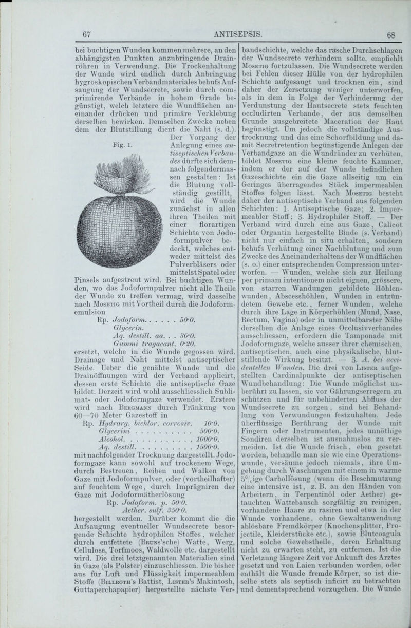 bei buchtigen Wunden kommen mehrere, an den abhängigsten Punkten anzubringende Drain- röhren in Verwendung. Die Trockenhaltung der Wunde wird endlich durch Anbringung hygroskopischen Verbandmateriales behufs Auf- saugung der Wundsecrete, sowie durch com- primirende Verbände in hohem Grade be- günstigt, welch letztere die Wundflächen an- einander drücken und primäre Verklebung derselben bewirken. Demselben Zwecke neben dem der Blutstillung dient die Naht (s. d.). Der Vorgang der Fig. l. Anlegung eines an- tiseptischen Verban- des dürfte sich dem- nach folgendermas- sen gestalten: Ist die Blutung voll- ständig gestillt, wird die Wunde zunächst in allen ihren Theilen mit einer florartigen Schichte von Jodo- formpulver be- deckt, welches ent- weder mittelst des Pulverbläsers oder mittelst Spatel oder Pinsels aufgestreut wird. Bei buchtigen Wun- den, wo das Jodoformpulver nicht alle Theile der Wunde zu treffen vermag, wird dasselbe nach Mosetig mit Vortheil durch die Jodoform- emulsion Rp. Jodoform 50’0. Glycerin. Aq. destill. aci. . . 30’0. Gummi tragacant. 0’20. ersetzt, welche in die Wunde gegossen wird. Drainage und Naht mittelst antiseptischer Seide. Ueber die genähte Wunde und die Drainöffnungen wird der Verband applicirt, dessen erste Schichte die antiseptische Gaze bildet. Derzeit wird wohl ausschliesslich Subli- mat- oder Jodoformgaze verwendet. Erstere wird nach Bergmann durch Tränkung von 60—70 Meter Gazestoff in Rp. Hydrarg. bichlor. corrosiv. 10-0. Glycerini ÖOO’O. Alcohol lOOO’O. Aq. destill 1500-0. mit nachfolgender Trocknung dargestellt. Jodo- formgaze kann sowohl auf trockenem Wege, durch Bestreuen. Reiben und Walken von Gaze mit Jodoformpulver, oder (vortheilhafter) auf feuchtem Wege, durch Imprägniren der Gaze mit Jodoformätherlösung Rp. Jodoform, p. 50’0. Aether. sulf. 350-0. hergestellt werden. Darüber kommt die die Aufsaugung eventueller Wundsecrete besor- gende Schichte hydrophilen Stoffes, welcher durch entfettete (BRUNs’sche) Watte, Werg, Cellulose, Torfmoos, Waldwolle etc. dargestellt wird. Die drei letztgenannten Materialien sind in Gaze (als Polster) einzuschliessen. Die bisher aus für Luft und Flüssigkeit impermeablem Stoffe (Billroth’s Battist, Lister’s Makintosh, Guttaperchapapier) hergestellte nächste Ver- bandschichte, welche das rasche Durchschlagen der Wundsecrete verhindern sollte, empfiehlt Mosetig fortzulassen. Die Wundsecrete werden bei Fehlen dieser Hülle von der hydrophilen Schichte aufgesaugt und trocknen ein. sind daher der Zersetzung weniger unterworfen, als in dem in Folge der Verhinderung der Verdunstung der Hautsecrete stets feuchten occludirten Verbände, der aus demselben Grunde ausgebreitete Maceration der Haut begünstigt. Um jedoch die vollständige Aus- trocknung und das eine Schorfbildung und da- mit Secretretention begünstigende Anlegen der Verbandgaze an die Wundränder zu verhüten, bildet Mosetig eine kleine feuchte Kammer, indem er der auf der Wunde befindlichen Gazeschichte ein die Gaze allseitig um ein Geringes überragendes Stück impermeablen Stoffes folgen lässt. Nach Mosetig besteht daher der antiseptische Verband aus folgenden Schichten: 1. Antiseptische Gaze; 2. Imper- meabler Stoff; 3. Hydrophiler Stoff. — Der Verband wird durch eine aus Gaze, Calicot oder Organtin hergestellte Binde (s. Verband) nicht nur einfach in situ erhalten, sondern behufs Verhütung einer Nachblutung und zum Zwecke des Aneinanderhaltens der Wundflächen (s. o.) einer entsprechenden Compression unter- worfen. — Wunden, welche sich zur Heilung per primam intentionem nicht eignen, grössere, von starren Wandungen gebildete Höhlen- wunden, Abscesshöhlen, Wunden in entzün- detem Gewebe etc.. ferner Wunden, welche durch ihre Lage in Körperhöhlen (Mund, Nase, Rectum, Vagina) oder in unmittelbarster Nähe derselben die Anlage eines Occlusivverbandes ausschliessen, erfordern die Tamponade mit Jodoformgaze, welche ausser ihrer chemischen, antiseptischen, auch eine physikalische, blut- stillende Wirkung besitzt. — 3. A. bei acci- dentellen Wunden. Die drei von Lister aufge- stellten Cardinalpunkte der antiseptischen Wundbehandlung: Die Wunde möglichst un- berührt zu lassen, sie vor Gährungserregern zu schützen und für unbehinderten Abfluss der Wundsecrete zu sorgen. sind bei Behand- lung von Verwundungen festzuhalten. Jede überflüssige Berührung der Wunde mit Fingern oder Instrumenten, jedes unnöthige Sondiren derselben ist ausnahmslos zu ver- meiden. Ist die Wunde frisch. eben gesetzt worden, behandle man sie wie eine Operations- wunde, versäume jedoch niemals, ihre Um- gebung durch Waschungen mit einem in warme 5\ige Carbollösung (wenn die Beschmutzung eine intensive ist, z. B. an den Händen von Arbeitern. in Terpentinöl oder Aether) ge- tauchten Wattebausch sorgfältig zu reinigen, vorhandene Haare zu rasiren und etwa in der Wunde vorhandene, ohne Gewaltanwendung ablösbare Fremdkörper (Knochensplitter, Pro- jectile, Kleiderstücke etc.), sowie Blutcoagula und solche Gewebstheile, deren Erhaltung nicht zu erwarten steht, zu entfernen. Ist die Verletzung längere Zeit vor Ankunft des Arztes gesetzt und von Laien verbunden worden, oder enthält die Wunde fremde Körper, so ist die- selbe stets als septisch inficirt zu betrachten und dementsprechend vorzugehen. Die Wunde