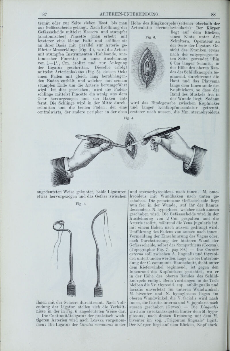 trennt oder zur Seite ziehen lässt, bis man zur Gefässscheide gelangt. Nach Eröffnung der Gefässscheide mittelst Messers und stumpfer (anatomischer) Pincette (man erhebt mit letzterer eine kleine Falte und eröffnet sie an ihrer Basis mit parallel zur Arterie ge- führter Messerklinge [Fig. 4]), wird die Arterie mit stumpfen Instrumenten (Hohlsonde, ana- tomischer Pincette) in einer Ausdehnung von 1—IVa Cm. isolirt und zur Anlegung der Ligatur geschritten. Dieselbe erfolgt mittelst Arterienhakens (Fig. 5), dessen Oehr einen Faden mit gleich lang herabhängen- den Enden enthält, und welcher mit seinem stumpfen Ende um die Arterie herumgeführt wird. Ist dies geschehen. wird die Faden- schlinge mittelst Pincette ein wenig aus dem Oehr hervorgezogen und der Haken ent- fernt. Die Schlinge wird in der Mitte durch- schnitten und die beiden Fäden. der eine centralwärts, der andere peripher in der oben Höhe des Ringknorpels (seltener oberhalb der Articulatio sternoclavicularis): Der Körper liegt auf dem Rücken, einen Klotz unter den Schultern. Operateur an der Seite der Ligatur. Ge- sicht des Kranken etwas nach der entgegengesetz- ten Seite gewendet. 1 Ein 6 Cm langer Schnitt, in der Höhe des oberen Ran- des des Schildknorpels be- ginnend. durchtrennt die Haut und das Platysma längs dem Innenrande des Kopfnickers, so dass der Rand des Muskels frei in der Wunde liegt. Sodann wird das Bindegewebe zwischen Kopfnicker und langer Kehlkopfmusculatur getrennt, ersterer nach aussen, die Mm. sternohyoideus Fig. 6. Fig 4. angedeuteten Weise geknotet, beide Ligaturen etwas hervorgezogen und das Gefäss zwischen Fig. 5. ihnen mit der Scheere durchtrennt. Nach Voll- endung der Ligatur stellen sich die Verhält- nisse in der in Fig. 6 angedeuteten Weise dar. — Die Continuitätsligatur der praktisch wich- tigeren Arterien wird nach Löbkkk vorgenom- men: Die Ligatur der Carotis communis in der und sternothyreoideus nach innen, M. omo- hyoideus mit Wundhaken nach unten ge- schoben. Die gemeinsame Gefässscheide liegt nun frei in der Wunde, auf ihr der Ramus descendens N. hvpoglossi, welcher nach aussen geschoben wird. Die Gefässscheide wird in der Ausdehnung von 2 Cm. gespalten und die Arterie isolirt. während die Vena jugularis int. mit einem Haken nach aussen gedrängt wird. Umführung des Fadens von aussen nach innen. Vermeidung der Einschnürung des Vagus oder, nach Durchstossung der hinteren Wand der Gefässscheide, selbst des Sympathicus (Coopek). (Topographie Fig. 7; pag. 89.) — Die Carotis externa soll zwischen A. lingualis und thyreoi- dea unterbunden werden. Lage wie bei Unterbin- dung der C. communis. Hautschnitt, dicht unter dem Kieferwinkel beginnend, ist gegen den Innenrand des Kopfnickers gerichtet, wo er in der Höhe des oberen Randes des Schild- knorpels endigt. Beim Vordringen in die Tiefe bleiben die Vv. thyreoid. sup., sublingualis und facialis unverletzt im unteren Wundwinkel; M. biventer und N. hypoglossus liegen im oberen Wundwinkel, die V. facialis wird nach innen, die Carotis interna und V. jugularis nach aussen geschoben (Guyon). — Die Lingualis wird am zweckinässigsten hinter dem M. hypo- glossus , nach dessen Kreuzung mit dem M. biventer im sog. „Trigonuni linguale“ ligirt. Der Körper liegt auf dem Rücken. Kopf stark