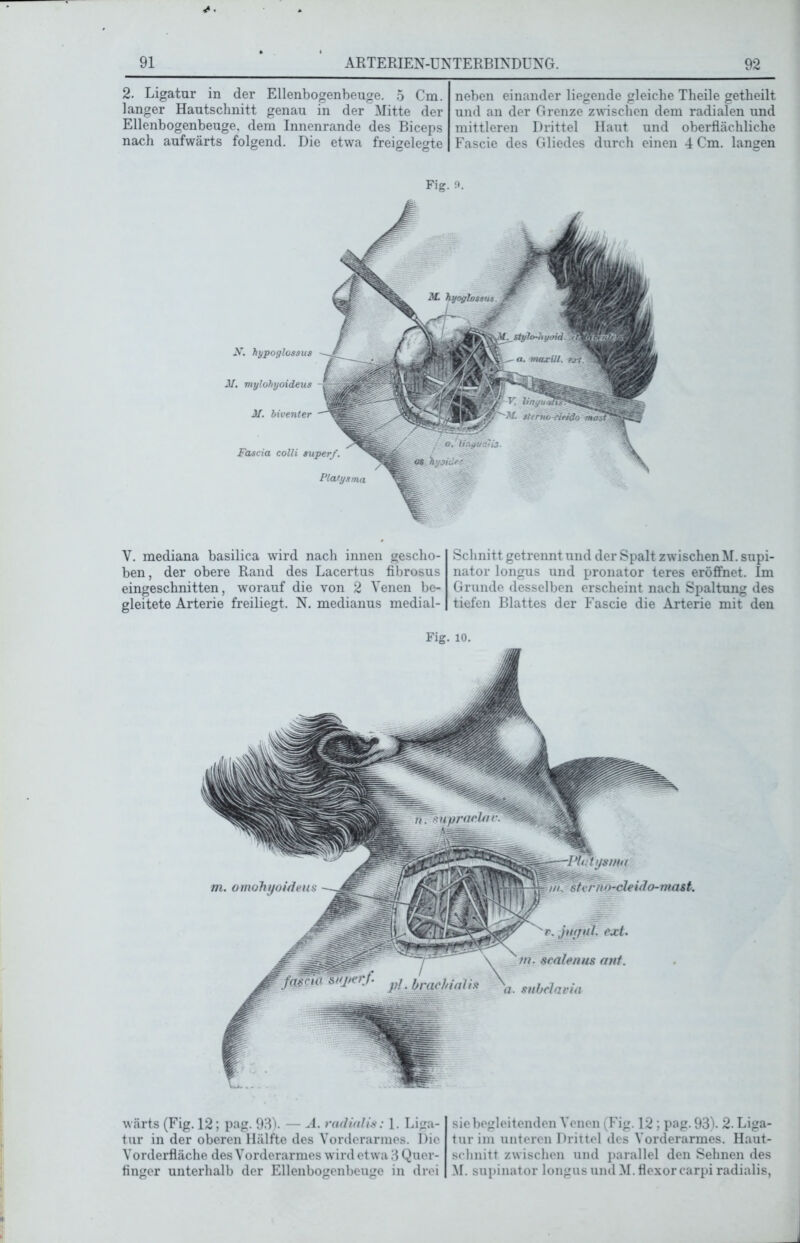 2. Ligatur in der Ellenbogenbeuge. 5 Cm. langer Hautschnitt genau in der Mitte der Ellenbogenbeuge, dem Innenrande des Biceps nach aufwärts folgend. Die etwa freigelegte neben einander liegende gleiche Theile getheilt und an der Grenze zwischen dem radialen und mittleren Drittel Haut und oberflächliche Fascie des Gliedes durch einen 4 Cm. langen Fig. 9. X. hypoglossus JI. mylohyoideus M. biventer Fascia colli super/. Platysma V. mediana basilica wird nach innen gescho- ben, der obere Rand des Lacertus fibrosus eingeschnitten, worauf die von 2 Venen be- gleitete Arterie freiliegt. N. medianus medial- Schnitt getrennt und der Spalt zwischen M. Supi- nator longus und pronator teres eröffnet. Im Grunde desselben erscheint nach Spaltung des tiefen Blattes der Fascie die Arterie mit den Fig. io. wärts (Fig. 12; pag. 93). — A. radial is: 1. Liga- tur in der oberen Hälfte des Vorderarmes. I)ic Vorderfläche des Vorderarmes wird etwa 3 Quer- finger unterhalb der Ellenbogenbeuge in drei siebegleitenden Venen (Fig. 12: pag. 93). 2. Liga- tur im unteren Drittel des Vorderarmes. Haut- schnitt zwischen und parallel den Sehnen des M. supinator longus und M. flexor carpi radialis,