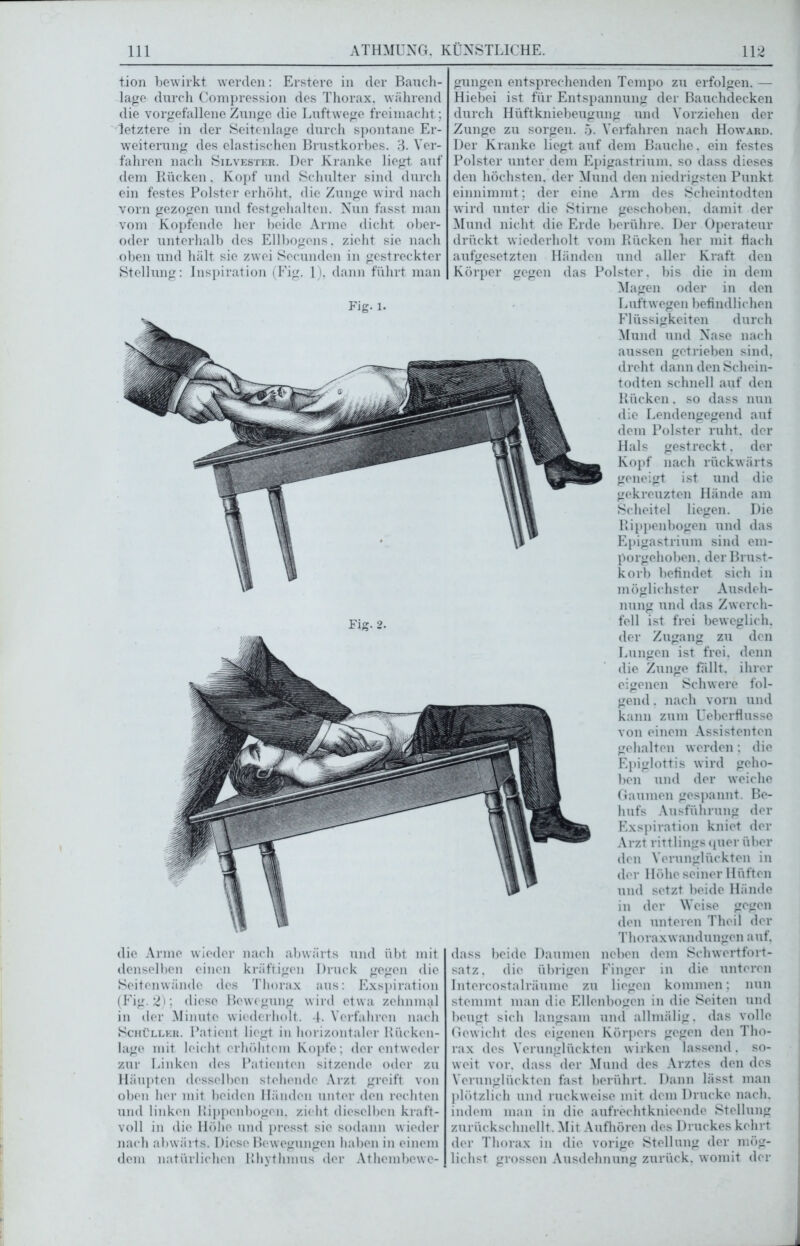 tion bewirkt werden: Erstere in der Bauch- lage durch Compression des Thorax, während die vorgefallene Zunge die Luftwege freimacht; letztere in der Seitenlage durch spontane Er- weiterung des elastischen Brustkorbes. 3. Ver- fahren nach Silvester. Der Kranke liegt auf dem Rücken, Kopf und Schulter sind durch ein festes Polster erhöht, die Zunge wird nach vorn gezogen und festgehalten. Nun fasst man vom Kopfende her beide Arme dicht ober- oder unterhalb des Ellbogens, zieht sie nach oben und hält sie zwei Secunden in gestreckter Stellung: Inspiration (Fig. 1), dann führt man Fig. 2. die Arme wieder nach abwärts und übt mit denselben einen kräftigen Druck gegen die Seitenwände des Thorax aus: Exspiration (Fig. 2); diese Bewegung wird etwa zehnmal in der Minute wiederholt. 4. Verfahren nach Schüller. Patient liegt in horizontaler Rücken- lage mit leicht erhöhtem Kopfe; der entweder zur Linken des Patienten sitzende oder zu Häupten desselben stehende Arzt greift von oben her mit beiden Händen unter den rechten und linken Hippenbogen, zieht dieselben kraft- voll in die Höhe und presst sie sodann wieder nach abwärts. Diese Bewegungen haben in einem dem natürlichen Rhythmus der Athembcwe- gungen entsprechenden Tempo zu erfolgen. — Hiebei ist für Entspannung der Bauchdecken durch Hüftkniebeugung und Vorziehen der Zunge zu sorgen. 5. Verfahren nach Howard. Der Kranke liegt auf dem Bauche. ein festes Polster unter dem Epigastrium. so dass dieses den höchsten, der Mund den niedrigsten Punkt einnimmt; der eine Arm des Scheintodten wird unter die Stirne geschoben, damit der Mund nicht die Erde berühre. Der Operateur drückt wiederholt vom Rücken her mit hach aufgesetzten Händen und aller Kraft den Körper gegen das Polster, bis die in dem Magen oder in den Flüssigkeiten durch aussen getrieben sind, todten schnell auf den die Lendengegend auf dem Polster ruht, der Hals gestreckt. der Kopf nach rückwärts geneigt ist und die gekreuzten Hände am Scheitel liegen. Die Rippenbogen und das Epigastrium sind em- porgehoben. der Brust- korb befindet sich in möglichster Ausdeh- nung und das Zwerch- fell ist frei beweglich, der Zugang zu den Lungen ist frei, denn die Zunge fällt, ihrer eigenen Schwere fol- gend. nach vorn und kann zum Ueberflusse von einem Assistenten Epiglottis wird geho- ben und der weiche Gaumen gespannt. Be- hufs Ausführung der Exspiration kniet der Arzt rittlings quer über den Verunglückten in der Höhe seiner Hüften und setzt beide Hände in der Weise gegen den unteren Theil der Thoraxwandungen auf. dass beide Daumen neben dem Schwertfort- satz. die übrigen Finger in die unteren Intercostalräume zu liegen kommen; nun stemmt man die Ellenbogen in die Seiten und beugt sich langsam und allmälig. das volle Gewicht des eigenen Körpers gegen den Tho- rax des Verunglückten wirken lassend. so- weit vor. dass der Mund des Arztes den des Verunglückten fast berührt. Dann lässt man plötzlich und ruckweise mit dem Drucke nach, indem man in die aufrechtknieende Stellung zurückschnellt. Mit Aufhören des Druckes kehrt der Thorax in die vorige Stellung der mög- lichst grossen Ausdehnung zurück, womit der
