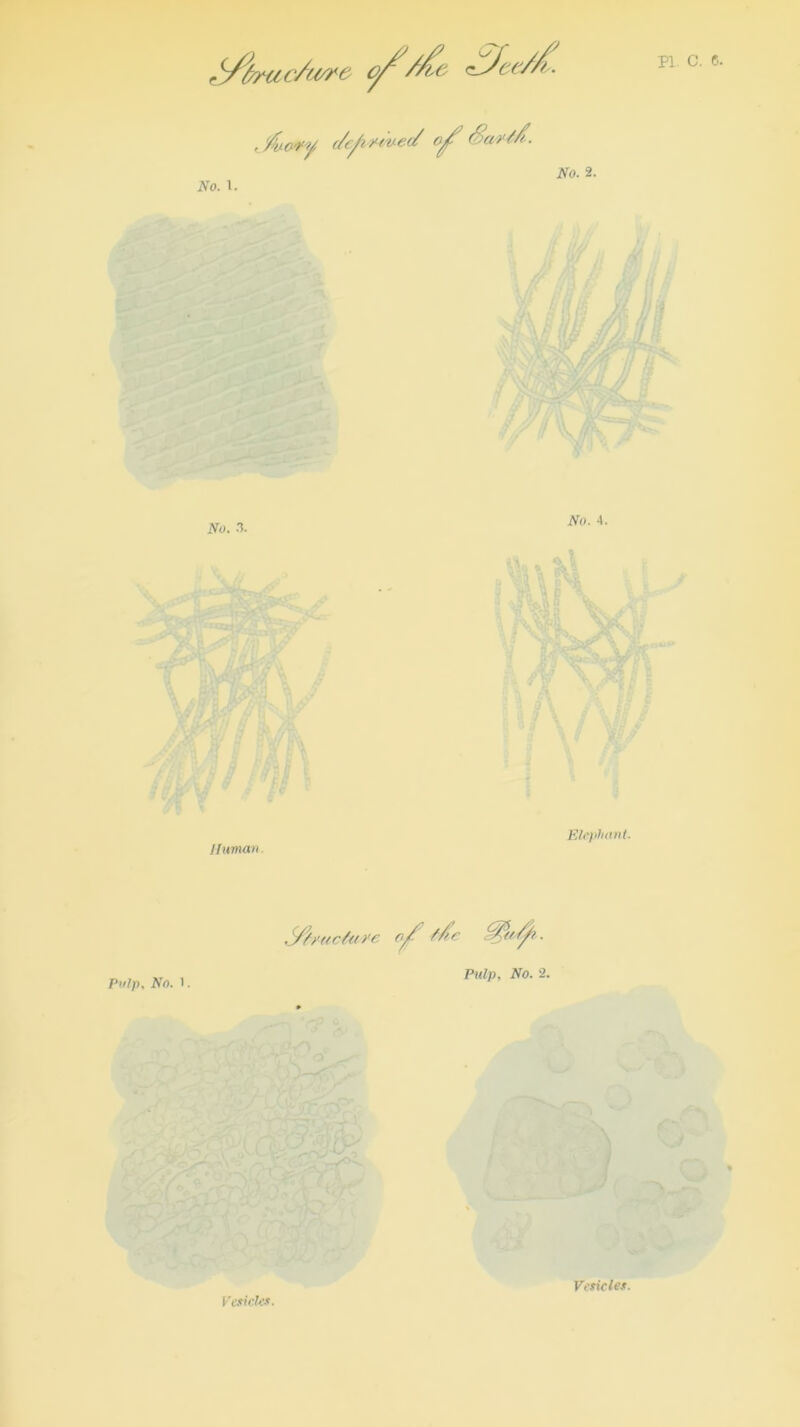 No. 2. No. 1. No. X No. 4. Human Elephant. Pulp, No. l. 'tctore f/t-e . Pulp, No. 2. Vender. Vesicles.