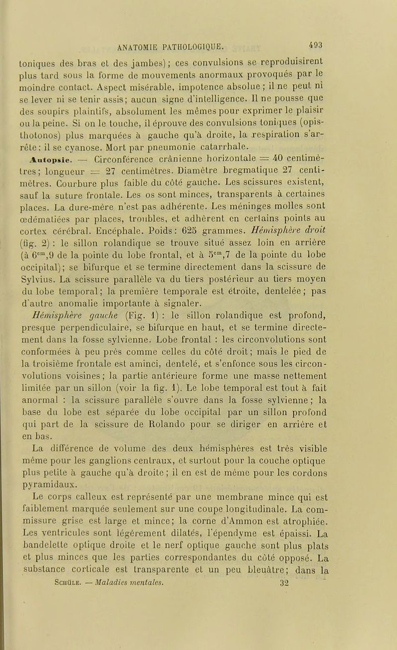 toniques des bras et des jambes); ces convulsions se reproduisirent plus tard sous la forme de mouvements anormaux provoqués par le moindre contact. Aspect misérable, impotence absolue ; il ne peut ni se lever ni se tenir assis; aucun signe d'intelligence. 11 ne pousse que des soupirs plaintifs, absolument les mêmes pour exprimer le plaisir ou la peine. Si on le touche, il éprouve des convulsions Ioniques (opis- thotonos) plus marquées à gauche qu’à droite, la respiration s’ar- rête: il se cyanose. Mort par pneumonie catarrhale. Autopsie. — Circonférence crânienne horizontale = 40 centimè- tres; longueur = 27 centimètres. Diamètre bregmatique 27 centi- mètres. Courbure plus faible du côté gauche. Les scissures existent, sauf la suture frontale. Les os sont minces, transparents à certaines places. La dure-mère n’est pas adhérente. Les méninges molles sont œdématiées par places, troubles, et adhèrent en cerlains points au cortex cérébral. Encéphale. Poids: G2o grammes. Hémisphère droit (tig. 2) : le sillon rolandique se trouve situé assez loin en arrière (à 6cm,9 de la pointe du lobe frontal, et à ocm,7 de la pointe du lobe occipital); se bifurque et se termine directement dans la scissure de Sylvius. La scissure parallèle va du tiers postérieur au tiers moyen du lobe temporal; la première temporale est étroite, dentelée; pas d'autre anomalie importante à signaler. Hémisphère gauche (Fig. 1) : le sillon rolandique est profond, presque perpendiculaire, se bifurque en haut, et se termine directe- ment dans la fosse sylvienne. Lobe frontal : les circonvolutions sont conformées à peu près comme celles du côté droit; mais le pied de la troisième frontale est aminci, dentelé, et s’enfonce sous les circon- volutions voisines; la partie antérieure forme une masse nettement limitée par un sillon (voir la fig. 1). Le lobe temporal est tout à fait anormal : la scissure parallèle s’ouvre dans la fosse sylvienne; la base du lobe est séparée du lobe occipital par un sillon profond qui part de la scissure de Rolando pour se diriger en arrière et en bas. La différence de volume des deux hémisphères est très visible même pour les ganglions centraux, et surtout pour la couche optique plus petite à gauche qu'à droite; il en est de même pour les cordons pyramidaux. Le corps calleux est représenté par une membrane mince qui est faiblement marquée seulement sur une coupe longitudinale. La com- missure grise est large et mince; la corne d’Ammon est atrophiée. Les ventricules sont légèrement dilatés, l’épendyme est épaissi. La bandelette optique droite et le nerf optique gauche sont plus plats et plus minces que les parties correspondantes du côté opposé. La substance corticale est transparente et un peu bleuâtre; dans la Scuüle. — Maladies mentales. 32