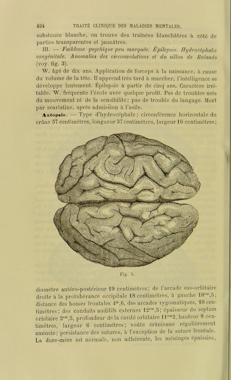 substance blanche, on trouve des traînées blanchâtres à cûté de parties transparentes et jaunâtres. III. — Faiblesse psychique peu marquée. Épilepsie. Hydrocéphalie cor,génitale. Anomalies des circonvolutions et du sillon de llolando (voy. fig. 3). W. âgé de dix ans. Application de forceps la naissance, à cause du volume de la tête. 11 apprend très tard à marcher, l’intelligence se développe lentement. Épilepsie à partir de cinq ans. Caractère irri- table. W. fréquente l’école avec quelque profit. Pas de troubles nets du mouvement ni de la sensibilité; pas de trouble du langage. Mort par scarlatine, après admission à l’asile. Autopsie. — Type d’hydrocéphale; circonférence horizontale du crâne 37 centimètres, longueur 37 centimètres, largeur 16 centimètres; diamètre antéro-postérieur 19 centimètres; de 1 arcade sus-orbitaire droite â la protubérance occipitale 18 centimètres, à gauche 18cm,5; distance des bosses frontales 4m,6, des arcades zygomatiques, 10 cen- timètres; des conduits auditifs externes 12cm,5; épaisseur du septum orbitaire 2cm,5, profondeur de la cavité orbitaire llcm2, hauteur 8 cen- timètres, largeur 6 centimètres; voûte crânienne régulièrement amincie; persistance des sutures, à l’exception de la suture frontale. La dure-mère est normale, non adhérente, les méninges épaissies,