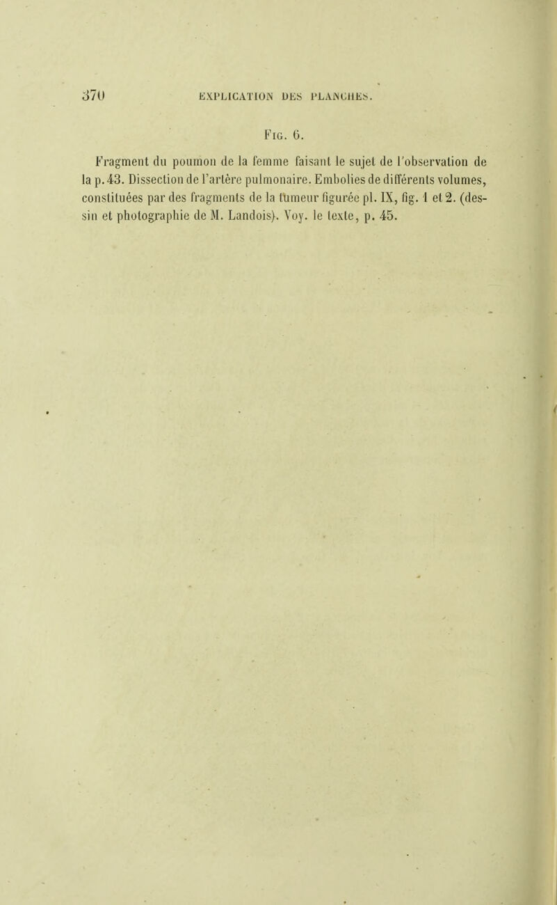 FlG. 6. Fragment du poumon de la femme faisant le sujet de l'observation de la p. 43. Dissection de l'artère pulmonaire. Embolies de différents volumes, constituées par des fragments de la tumeur figurée pl. IX, fig. 1 et 2. (des- sin et photographie de M. Landois). Voy. le texte, p. 45.