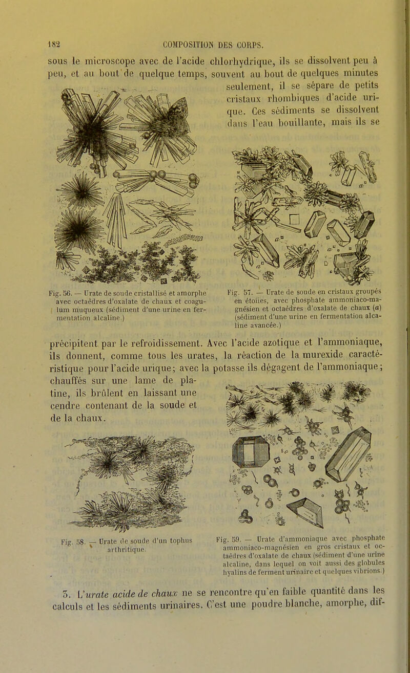 SOUS le microscope avec de l'acide clilorhydrique, ils se dissolvent peu à peu, et au bout'de quelque temps, souvent au bout de quelques minutes seulement, il se sépare de petits cristaux rhombiques d'acide uri- que. Ces sédiments se dissolvent clans l'eau bouillante, mais ils se Fig. 36. — Urate de soude cristaUisé et amorphe Fig. 57. — Urate de soude en cristaux groupés avec octaèdres d'oxalate de chaux et coagu- en étoiles, avec phospliale amraoniaco-ma- lum muqueux (sédiment d'une urine en fer- gnésien et octaèdres d'oxalate de chaux (a) mentation alcaline ) {sédiment d'une urine en fermentation alca- line avancée.) précipitent par le refroidissement. Avec l'acide azotique et l'ammoniaque, ils donnent, comme tous les urates, la réaction de la murexide caracté- ristique pour l'acide urique; avec la potasse ils dégagent de l'ammoniaque; chauffés sur une lame de pla- tine, ils brûlent en laissant une cendre contenant de la soude et de la chaux. Picr 38 — Hrate de soude d'un tophus Fig. S9. - Urate d'ammoniaque avec phosphate  ^ arthritique. ammoniaco-raagnésien en gros cristaux et oc- taèdres d'oxalate de chaux (sédiment d'une urine alcaline, dans lequel on voit aussi des globules hyalins de ferment urinaire et quelques vibrions.) 5. Vurate acide de chaux ne se rencontre qu'en faible quantité dans les calculs et les sédiments urinaires. C'est une poudre blanche, amorphe, dif-