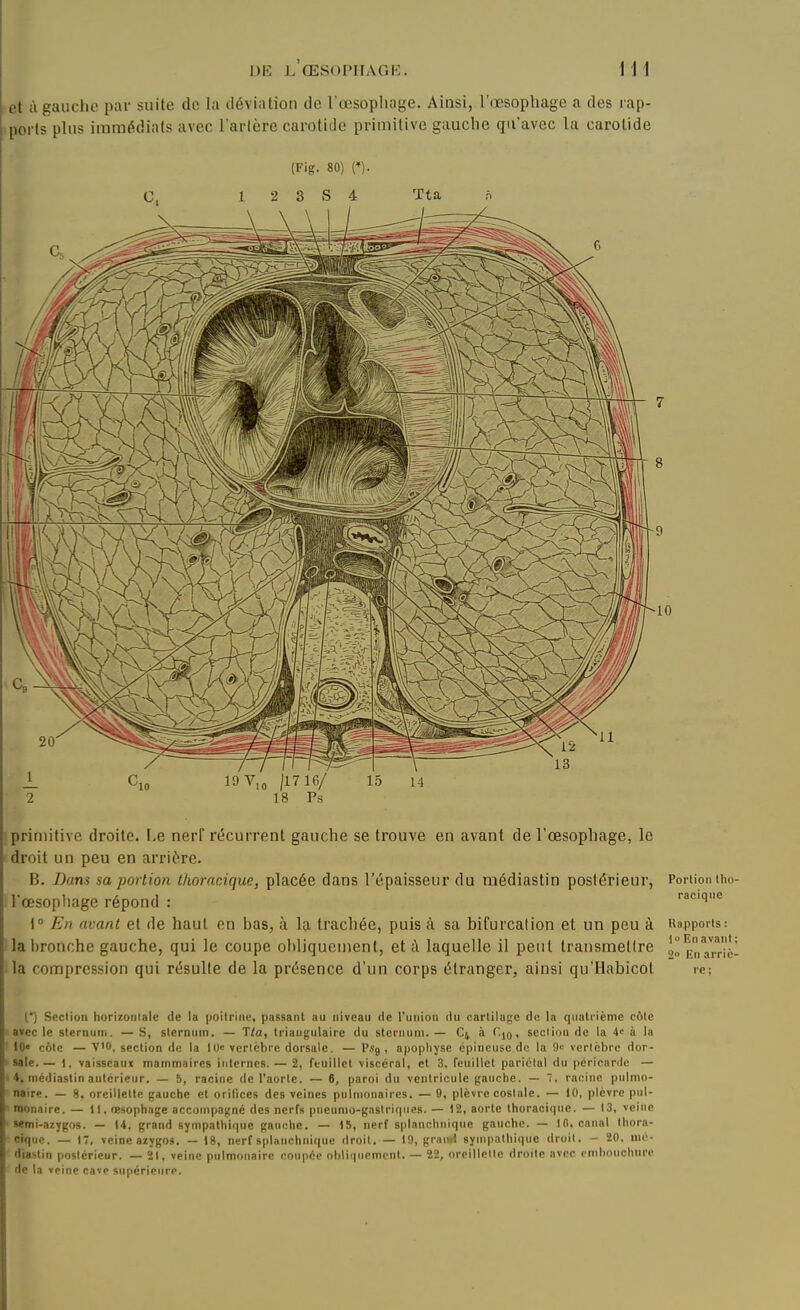 DE l'œSOPITAGK. 1 1 1 \ et à gauche par suite de la déviation de l'œsopliage. Ainsi, l'œsophage a des rap- ports pUis immédiats avec Tarière carotide primitive gauche qu'avec la carotide (Fig. 80) n- C, 1 2 3 s 4 Tta n primitive droite. I.e nerf récurrent gauche se trouve en avant de l'œsophage, le droit un peu en arrière. B. Dans sa portion thoracique, placée dans l'épaisseur du médiastin postérieur, l'œsopliage répond : 1° En avant et de haut en bas, à la tracliée, puis à sa bifurcation et un peu à la bronche gauche, qui le coupe obliquement, et à laquelle il peut transmettre la compression qui résulte de la présence d'un corps étranger, ainsi qu'Ilabicot Portion tho- racique Rapports ; En avant; 2 En arriè- re : (*) Section horizontale de la poitrine, passant au niveau de l'union du cartilage de In quatrième côte avec le sternum. — S, sternum. — 'îla, triangulaire du sternum. — C4 à T.jo, section de la 4<' à la I0« côte — V'O, section de la IIK vertèbre dorsale. — PS9 , apophyse épineuse de la O-' vertèbre dor- sale.— 1, vaisseaux mammaires internes. — 2, feuillet viscéral, cl 3, feuillet pariétal du péricarde — 4, médiastin antérieur. — 5, racine de l'aorte. — 6, paroi du ventricule gauche. — , racine pulmo- naire. — 8, oreillette gauche et orifices des veines pulmonaires. — 9, plèvre costale. — 10, plèvre pul- monaire. — 11. œsophage accompagné des nerfs pneunio-gastriqnes. — 12, aorte thoracique. — 13, veine •emi-azygos. — 14. grand sympathique gauche. — 15, nerf splanchnique gauche. — Ifi. canal thora- cique. — 17, veine azygos. — 18, nerf splanchnique droit. — 19, grai»! synqiathique droit. - 20, mé- diastin postérieur. — 21, veine pulmonaire coupée obliquement. — 22, orcillelle droite avec omlinnchtire de la veine cave supérieure.